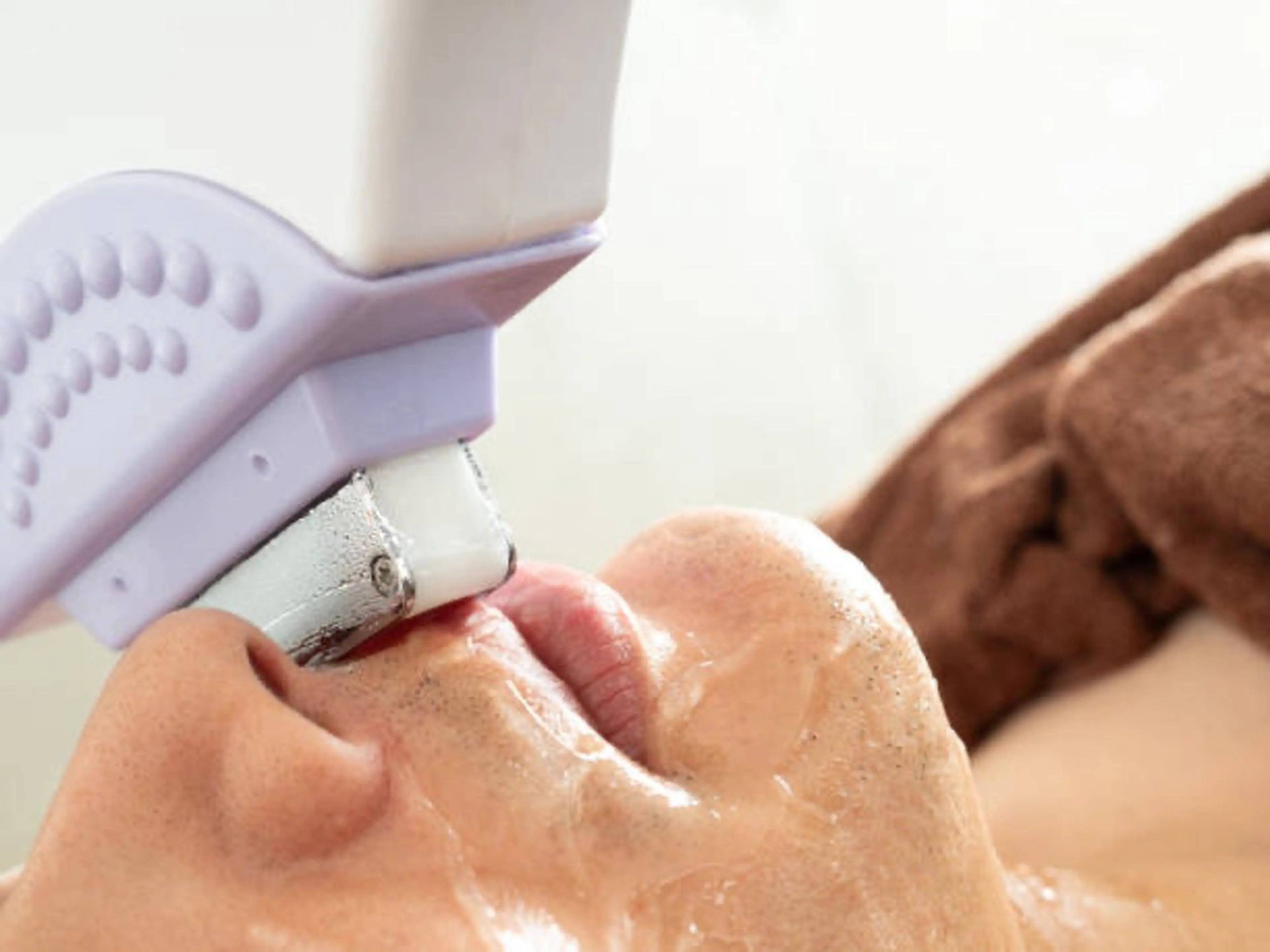 【メンズ】ヒゲ脱毛の写真