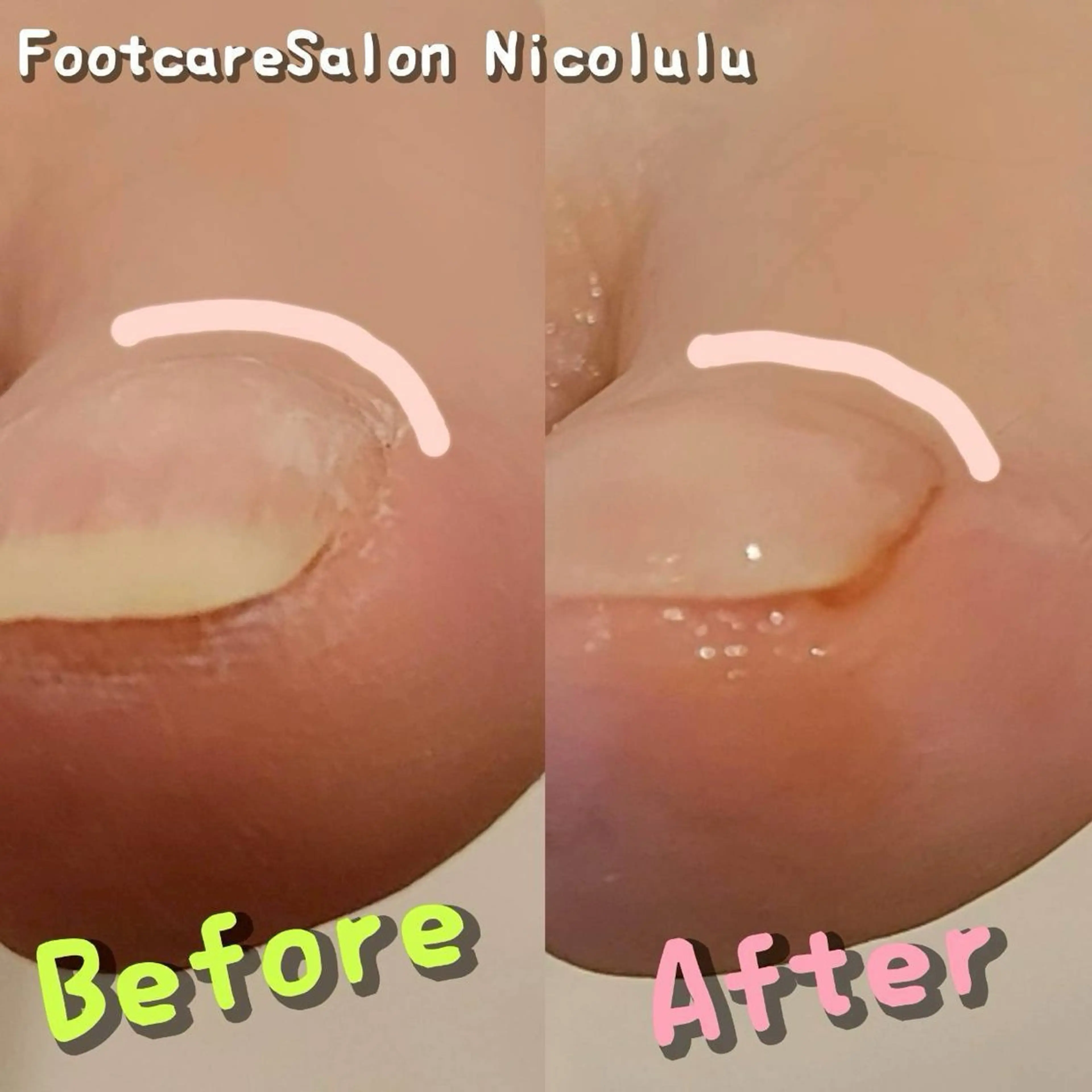 リラク 足トラブル専門 ニコルル金沢のエステ・リラクイメージ