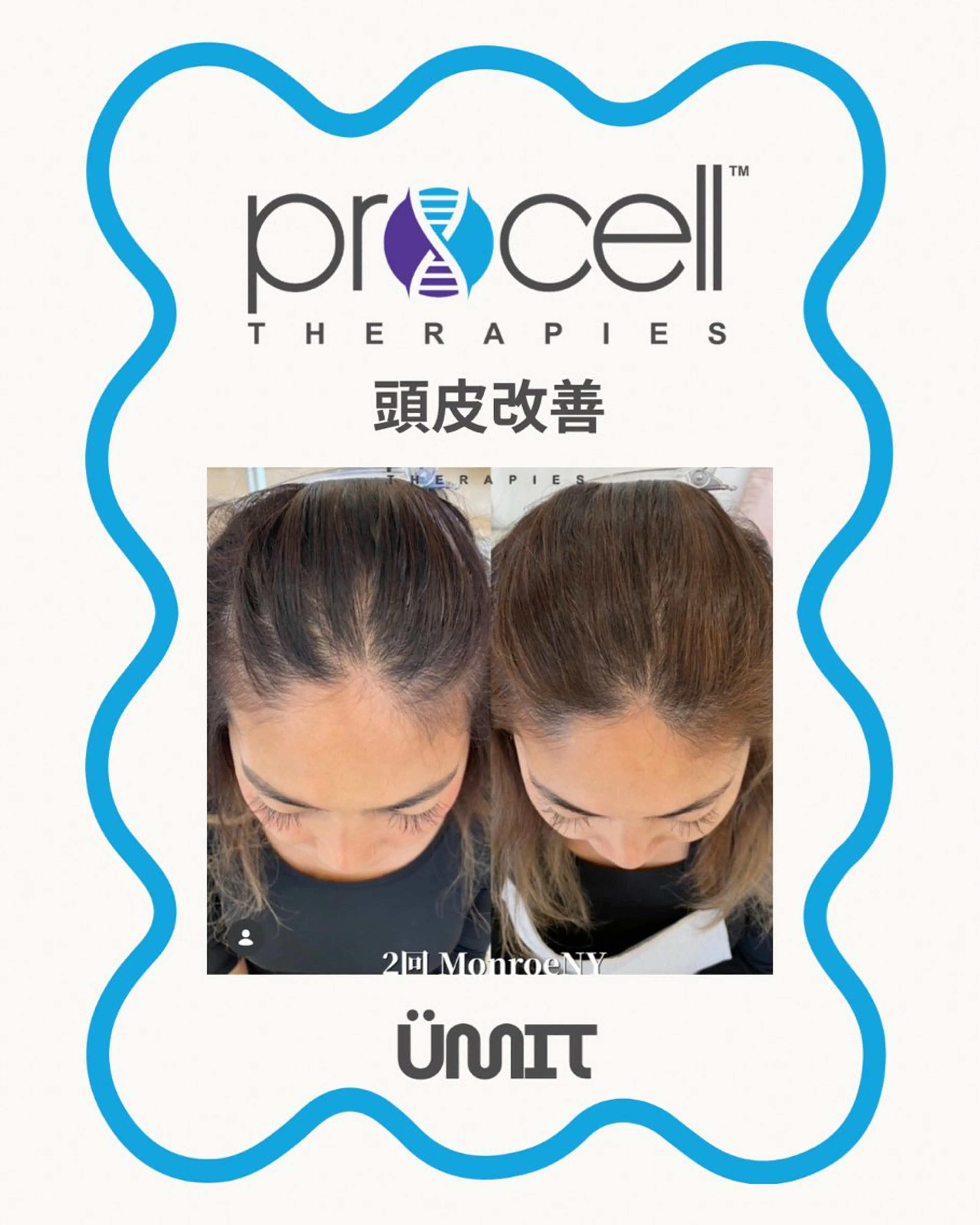 ヘッドスパ Ümit（ユミト） プロセルセラピーズのネイルデザイン