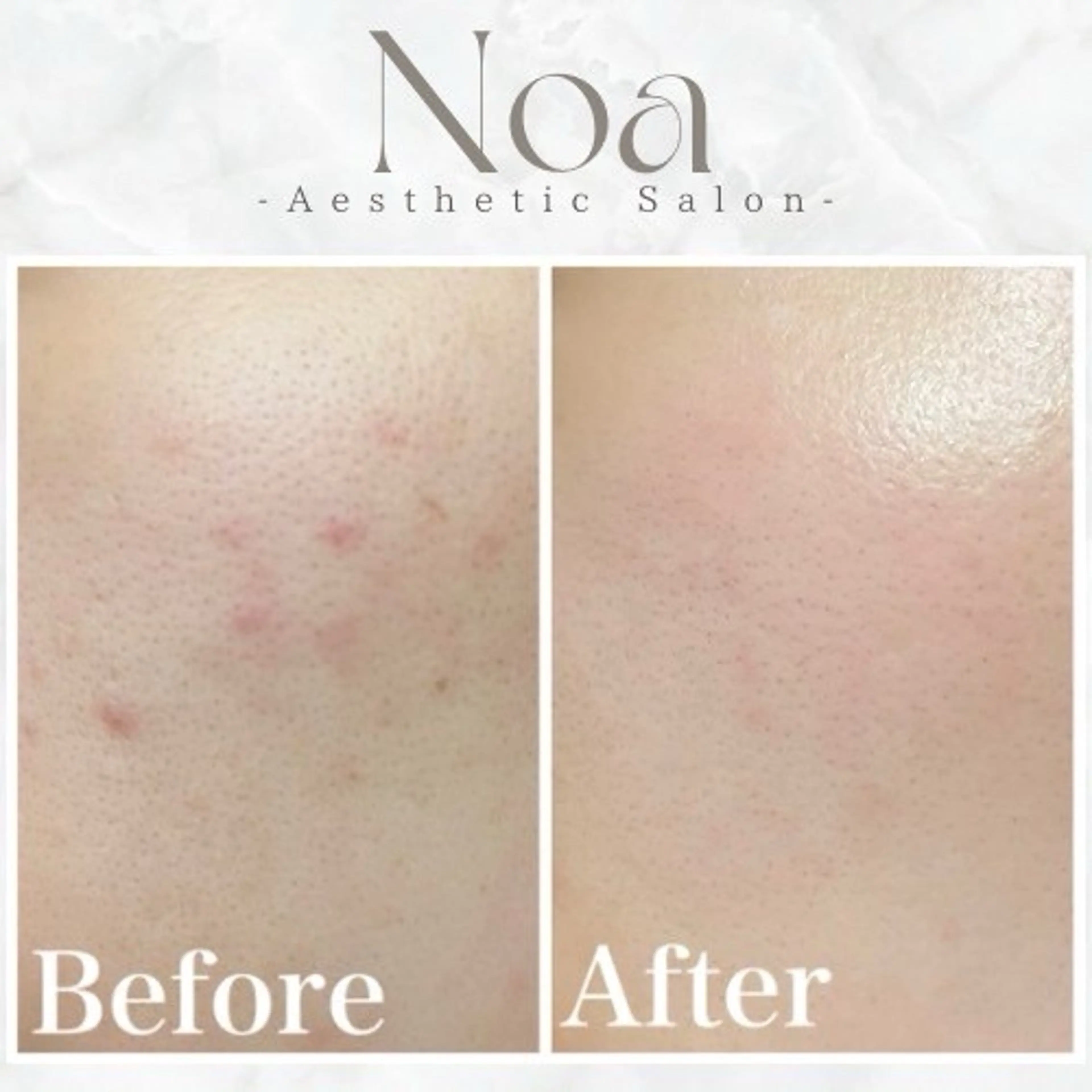 肌質改善サロン Noaのエステ・リラクイメージ