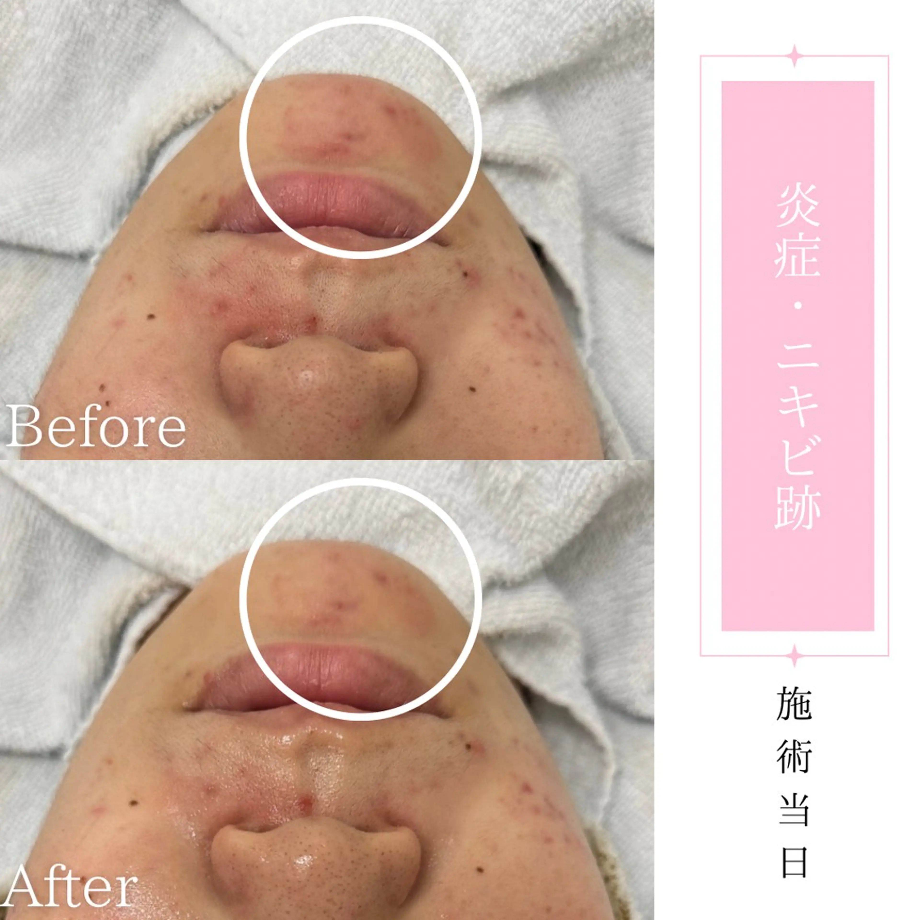 エステ BestBelleꕤ 大阪福島/肌質改善のエステ・リラクイメージ