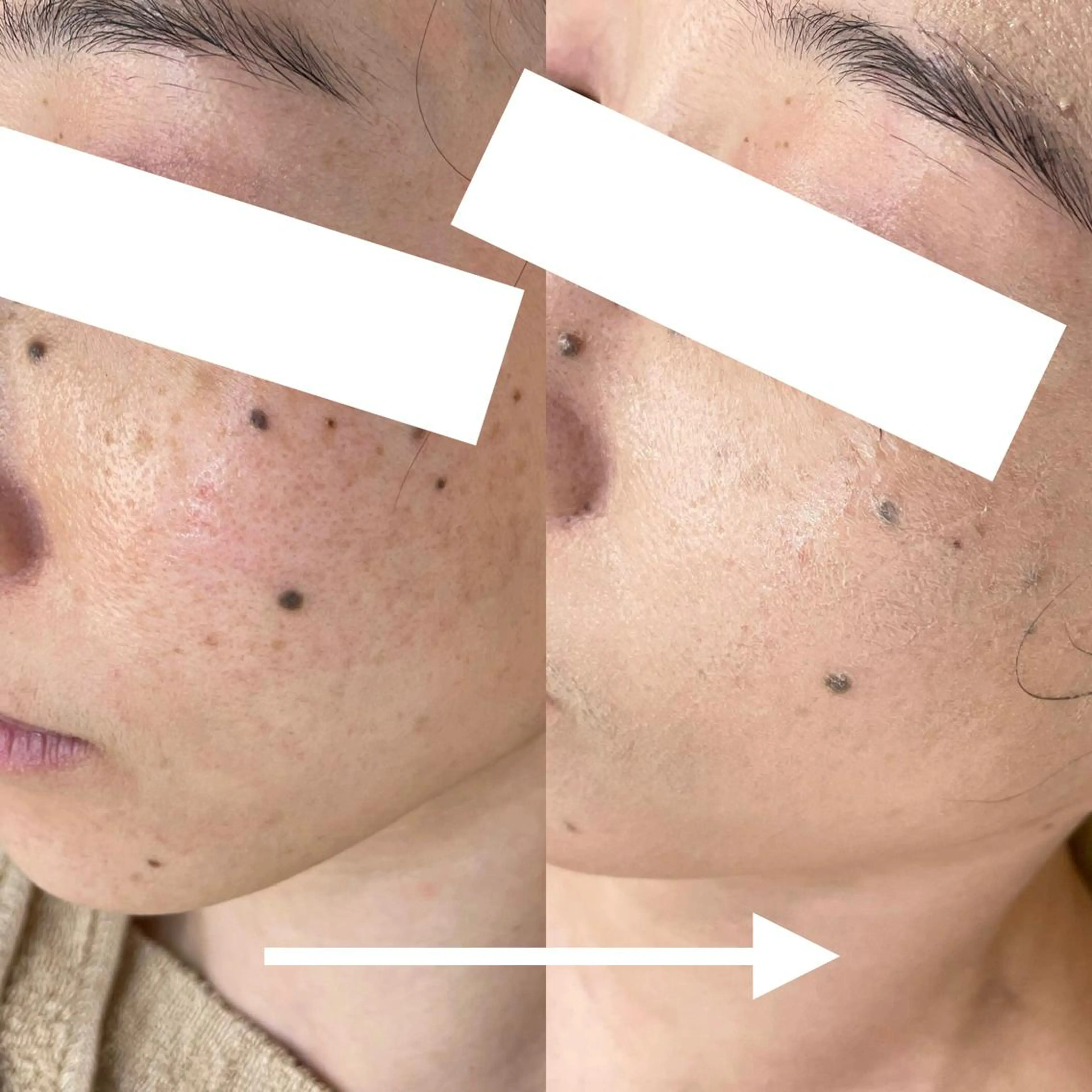 グリーンピール専門店 🌿エルモナのエステ・リラクイメージ