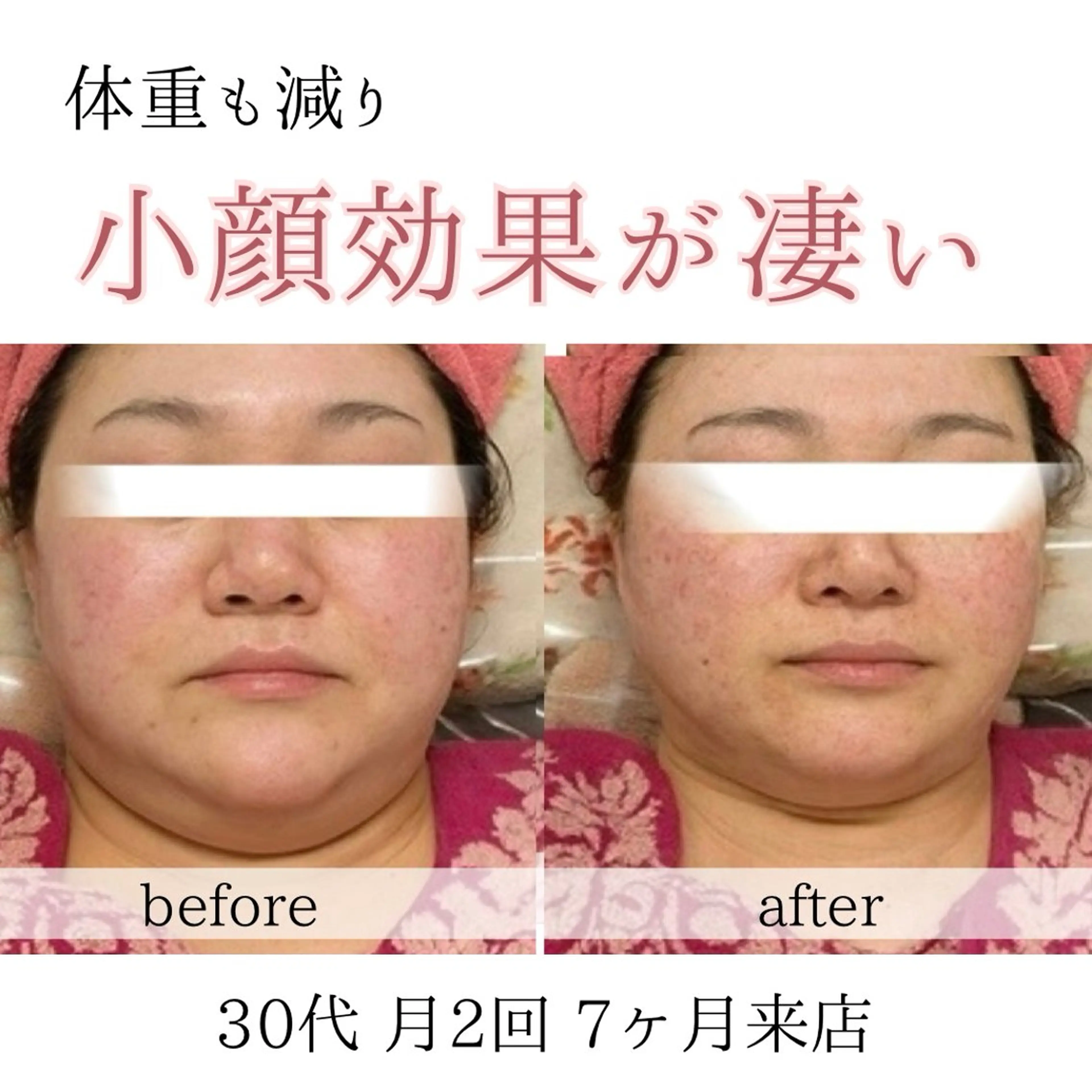 小顔・ニキビ ・脱毛サロンのエステ・リラクイメージ