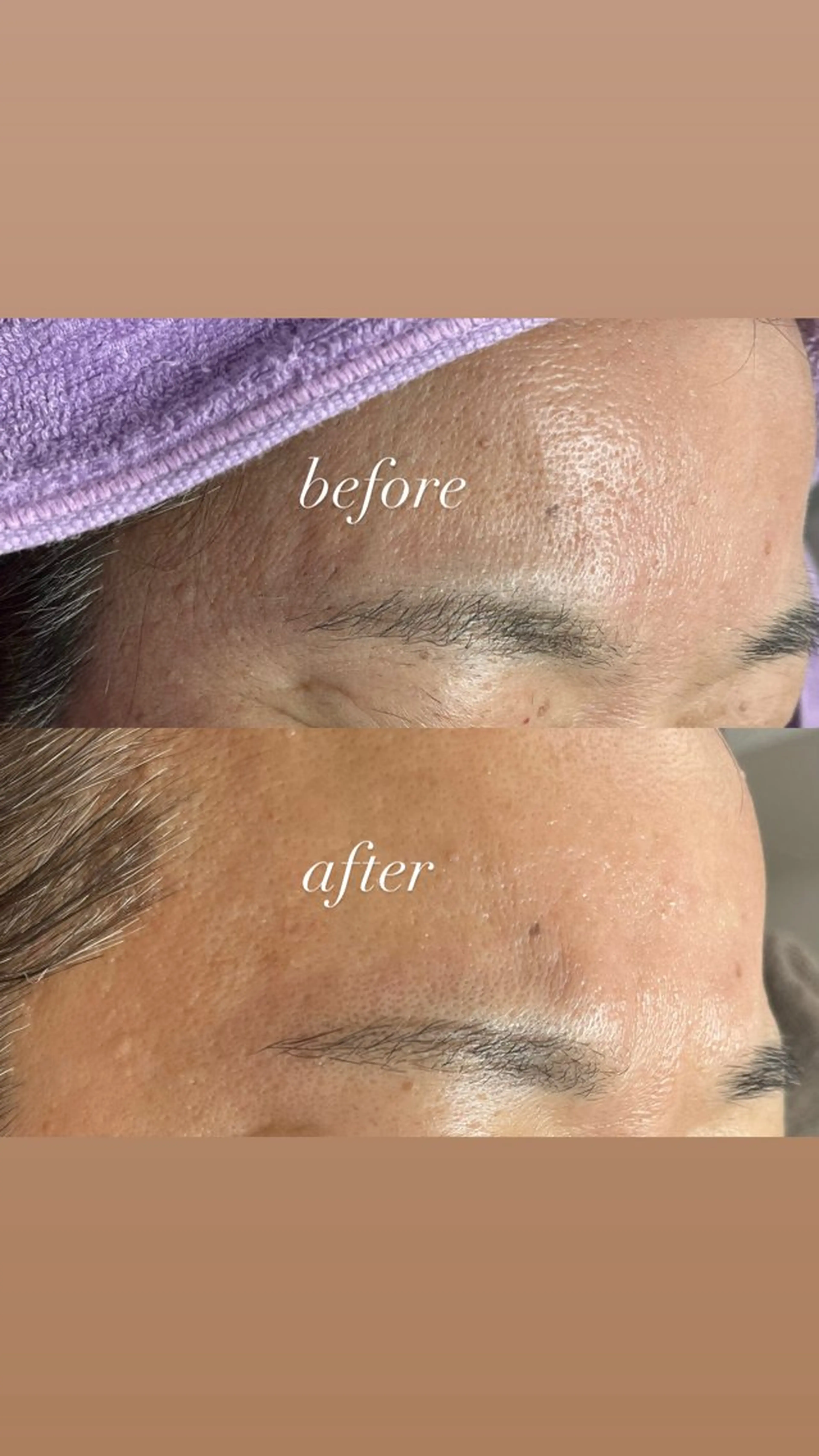 アイブロウ ワックス脱毛 眉カット その他(アイブロウ) iti 眉毛とワックス脱毛の眉毛・アイブロウイメージ