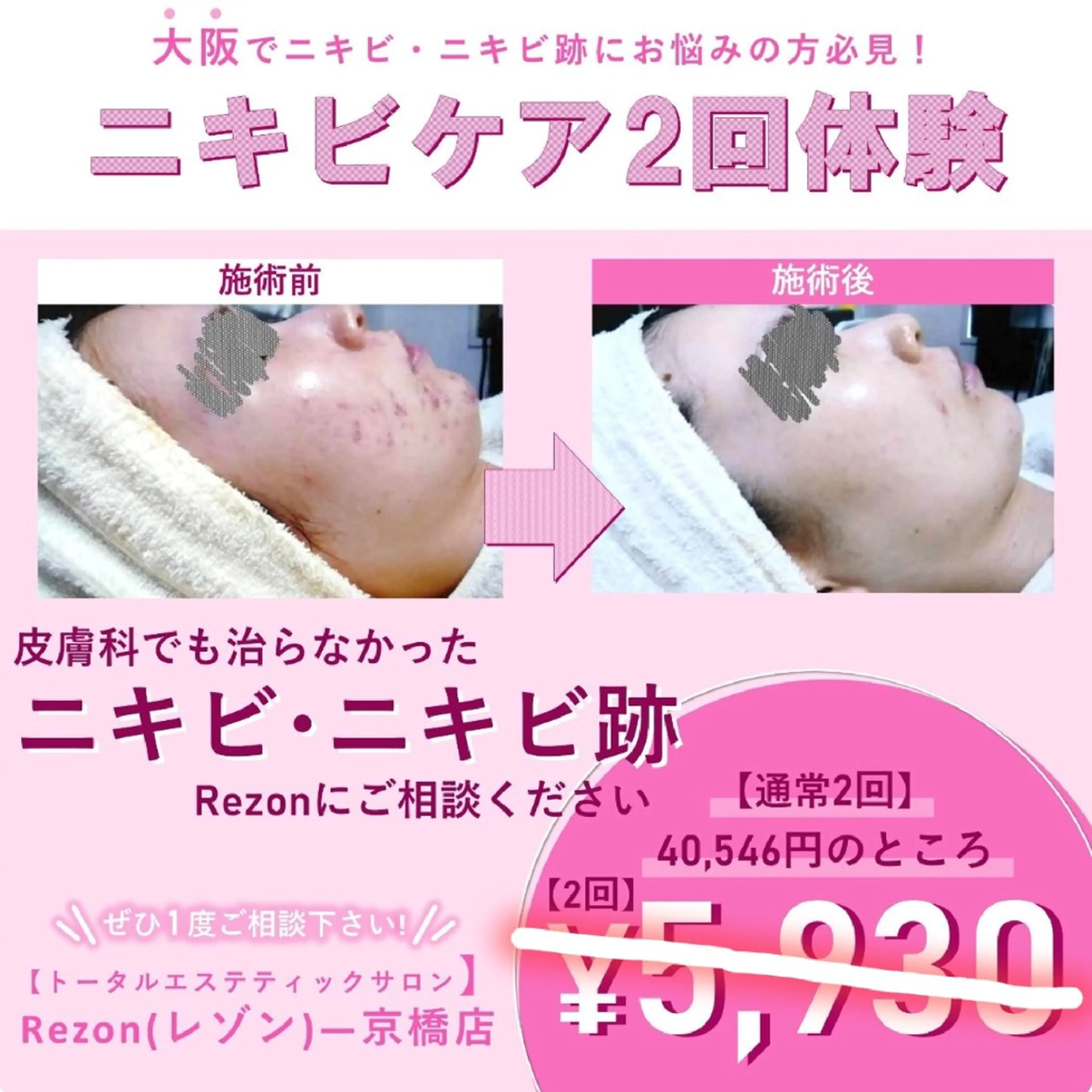 エステ 〈ニキビケアサロン〉 レゾン京橋店/ 浅川のエステ・リラクイメージ