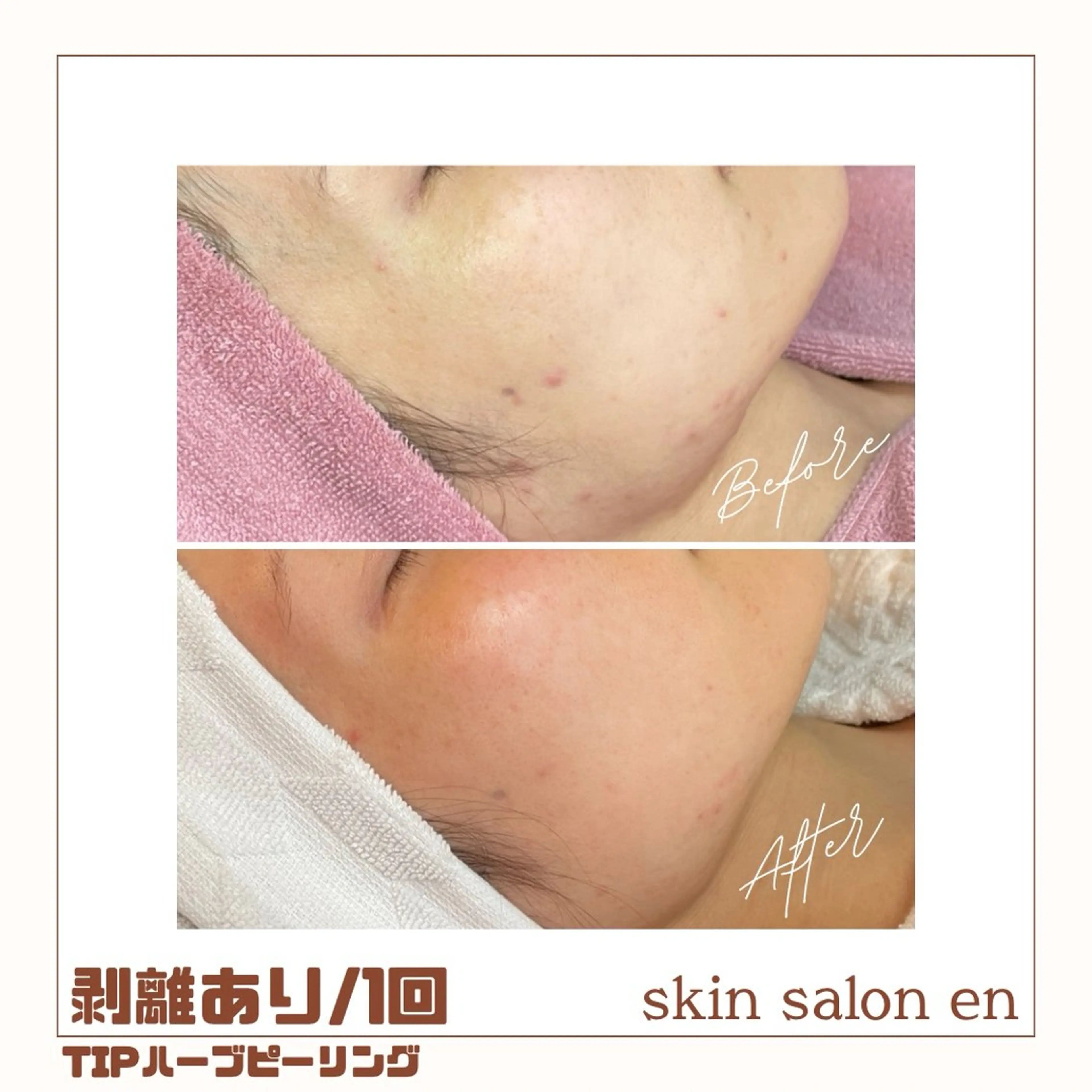 エステ skin salon enのエステ・リラクイメージ