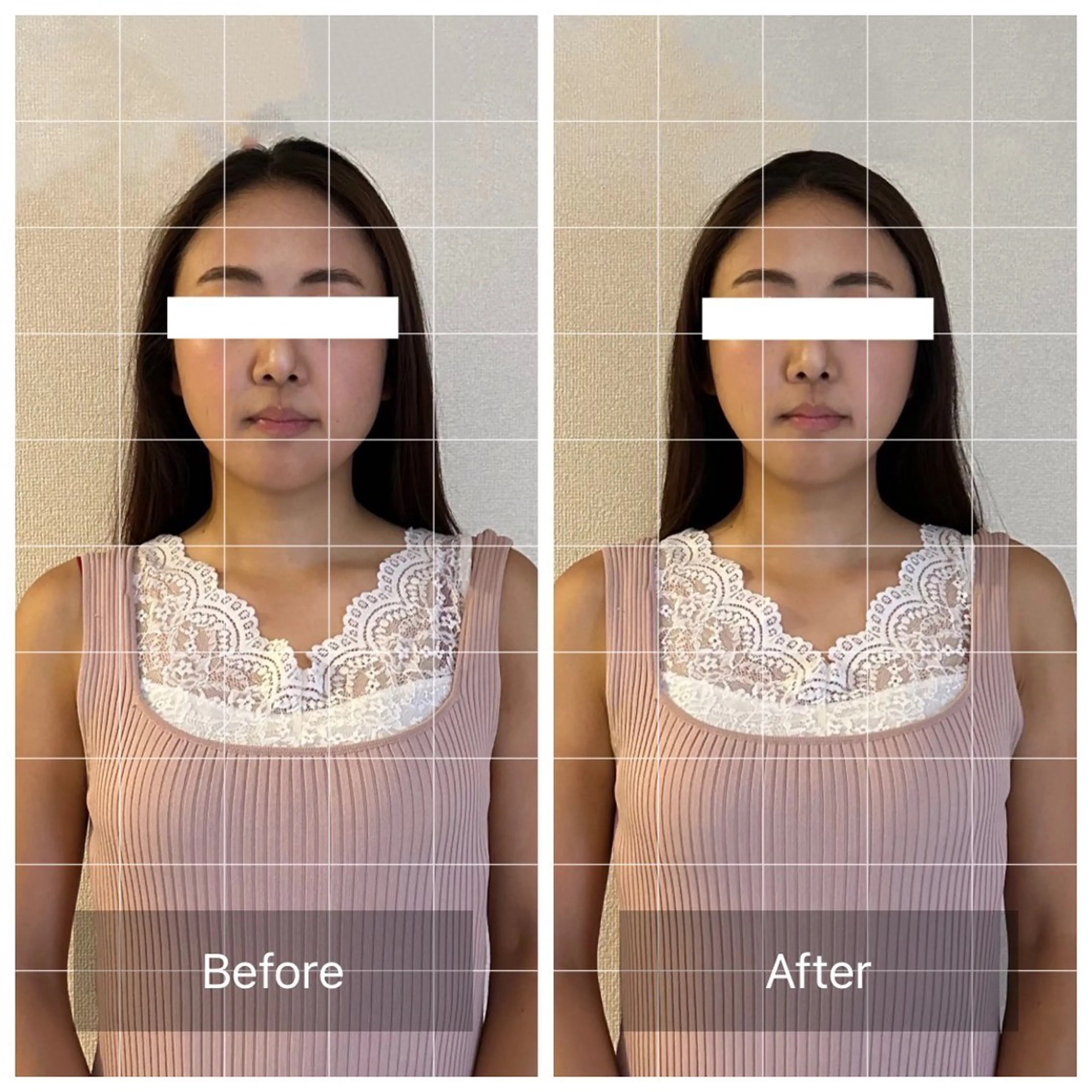 新感覚マシン× ドライヘッドのエステ・リラクイメージ