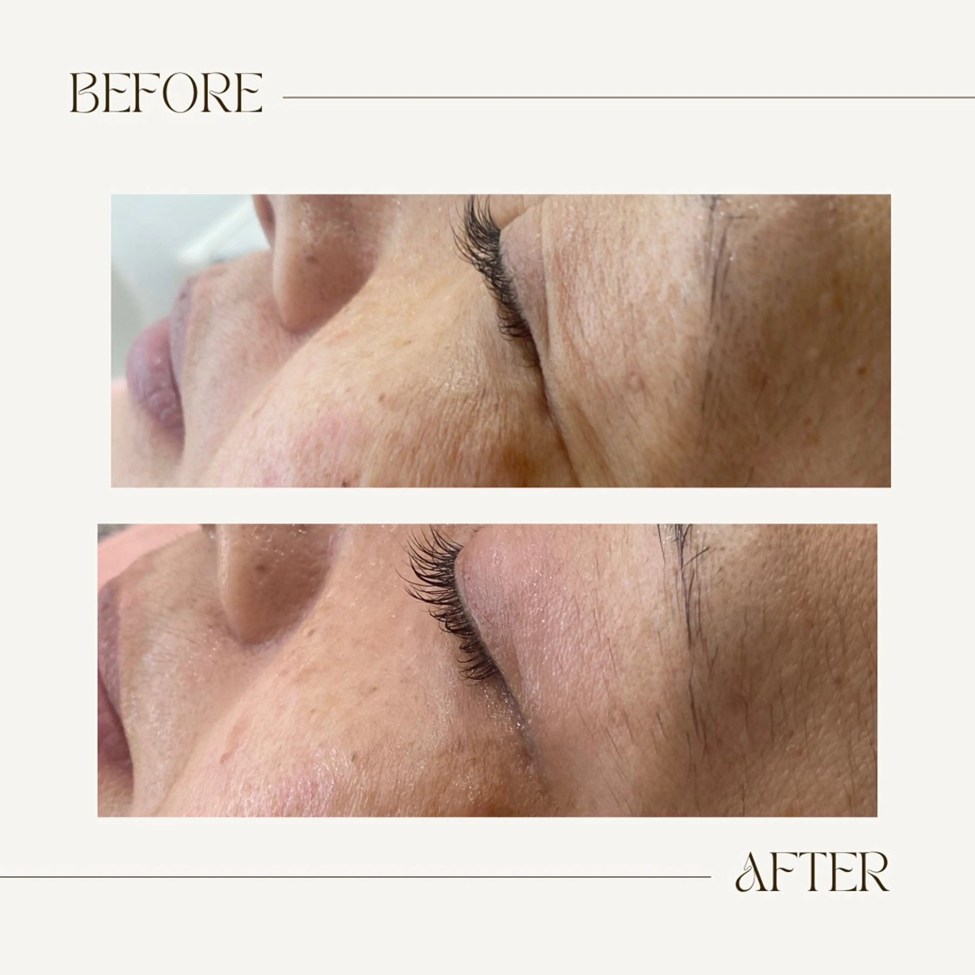 CEsalonEgg 齋藤のエステ・リラクイメージ