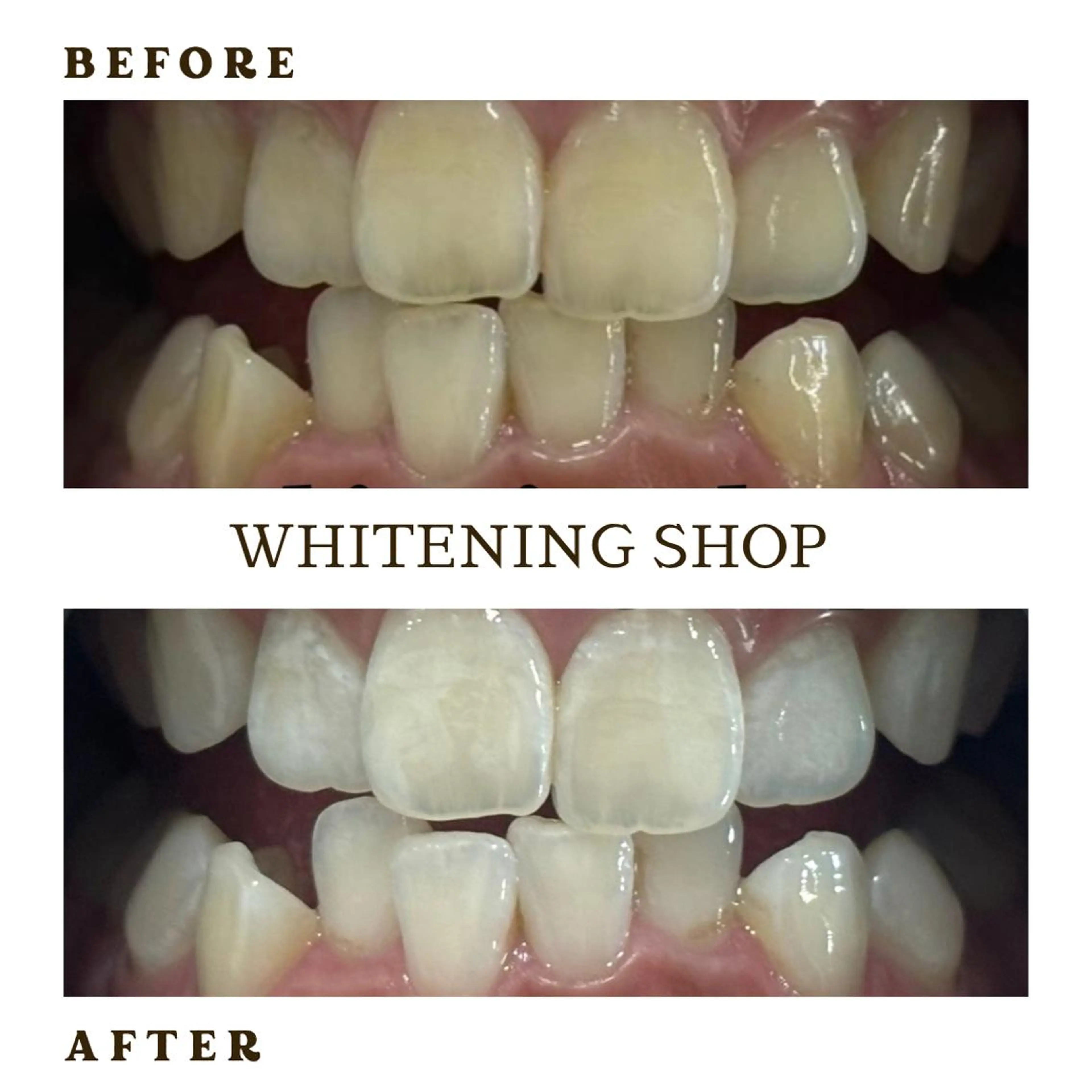 メンズ その他 ホワイトニング ショップ葛西店のその他イメージ