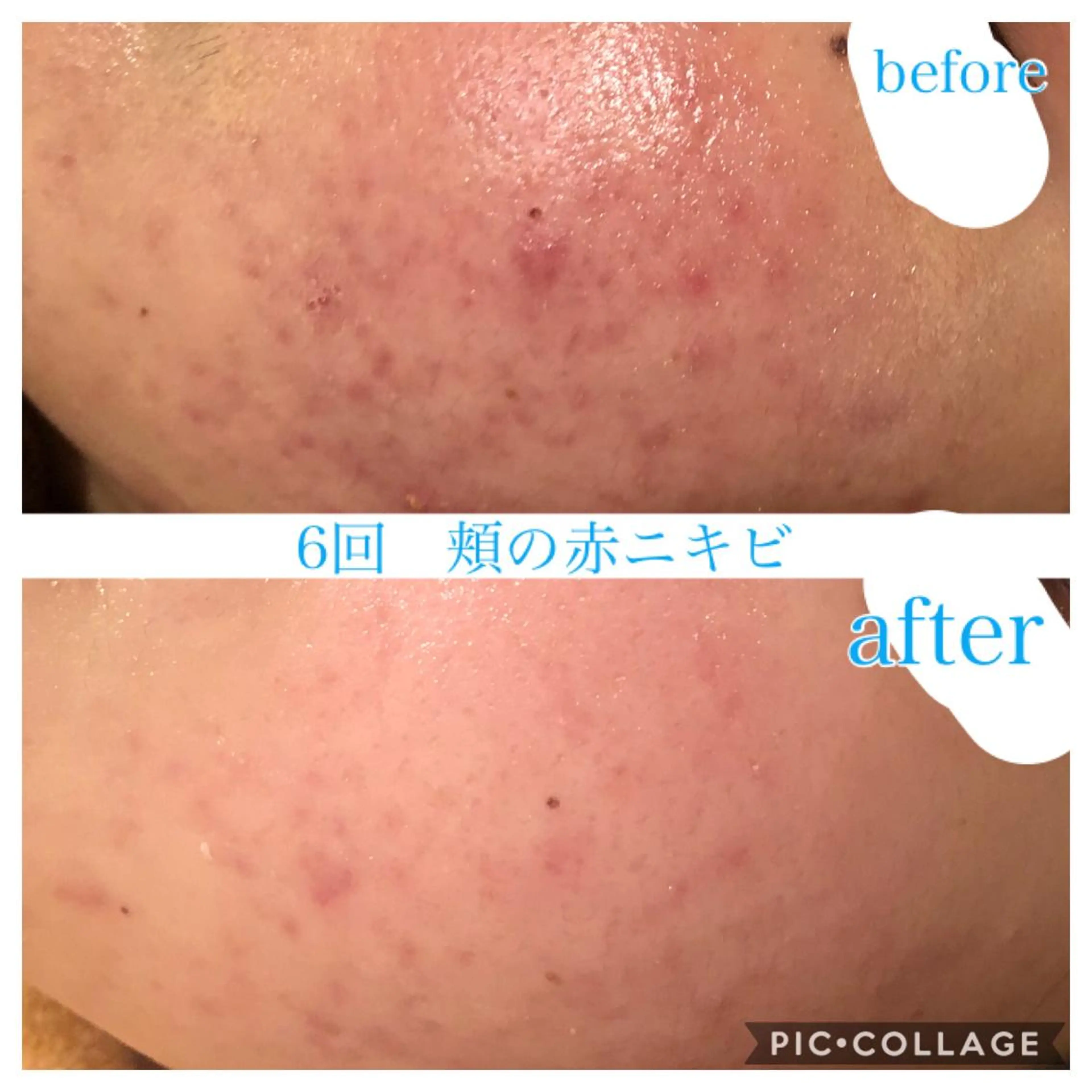 セミロング カラー パーマ ヘアアレンジ メンズ キッズ ネイル マツエク・マツパ エステ リラク EnsorClair 代表　野口真央のエステ・リラクイメージ