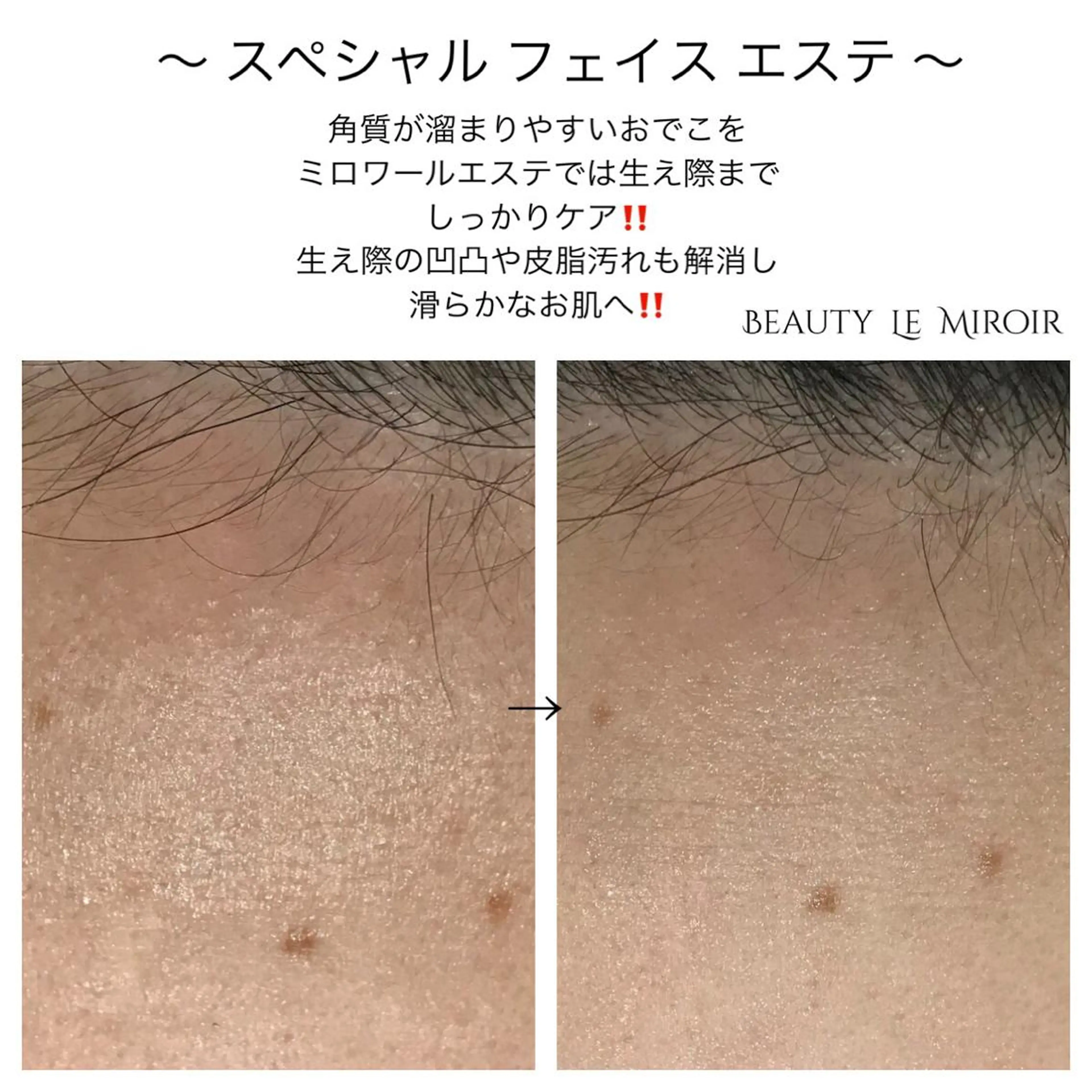 ビューティー ミロワールのエステ・リラクイメージ