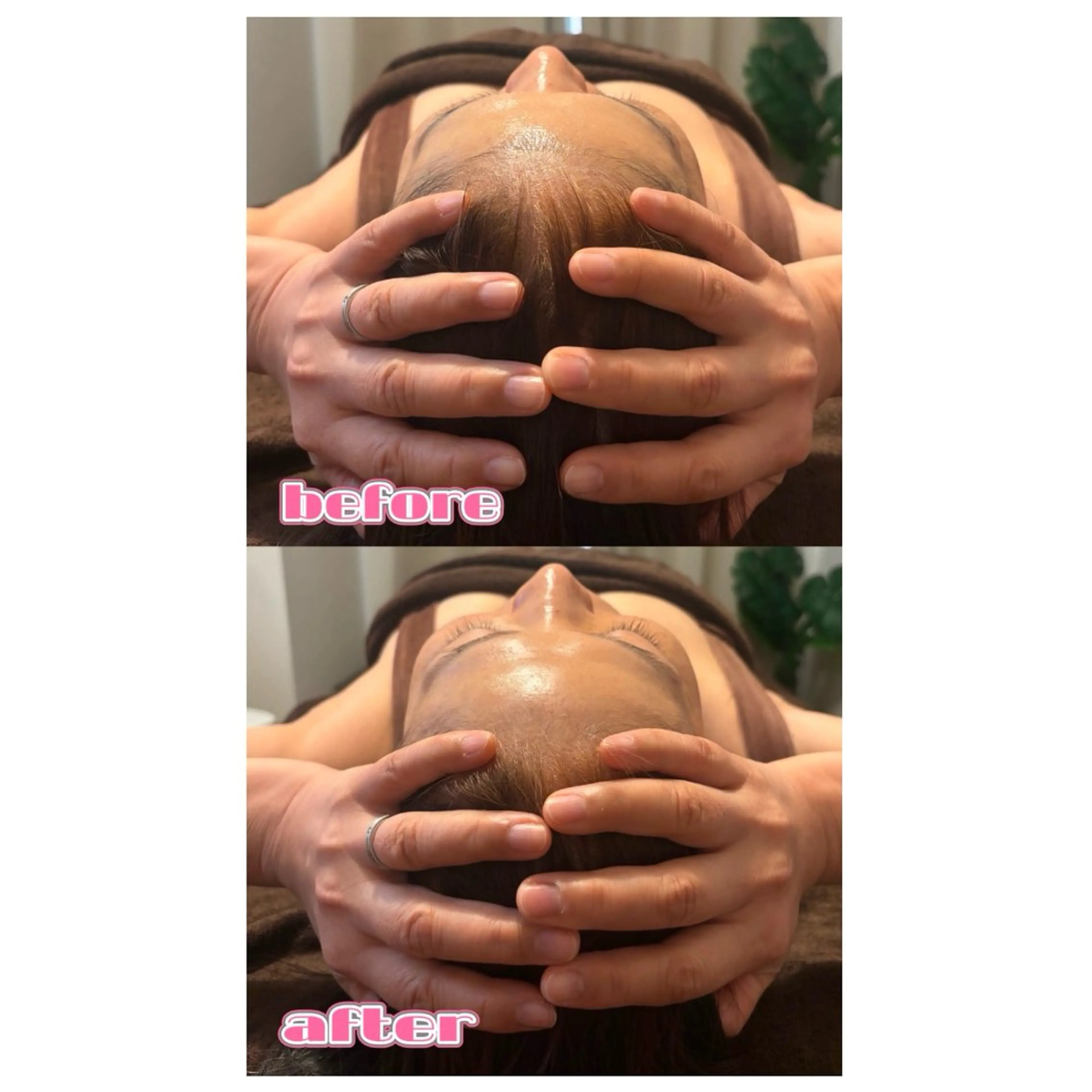 MIRAI小顔 栄店のエステ・リラクイメージ