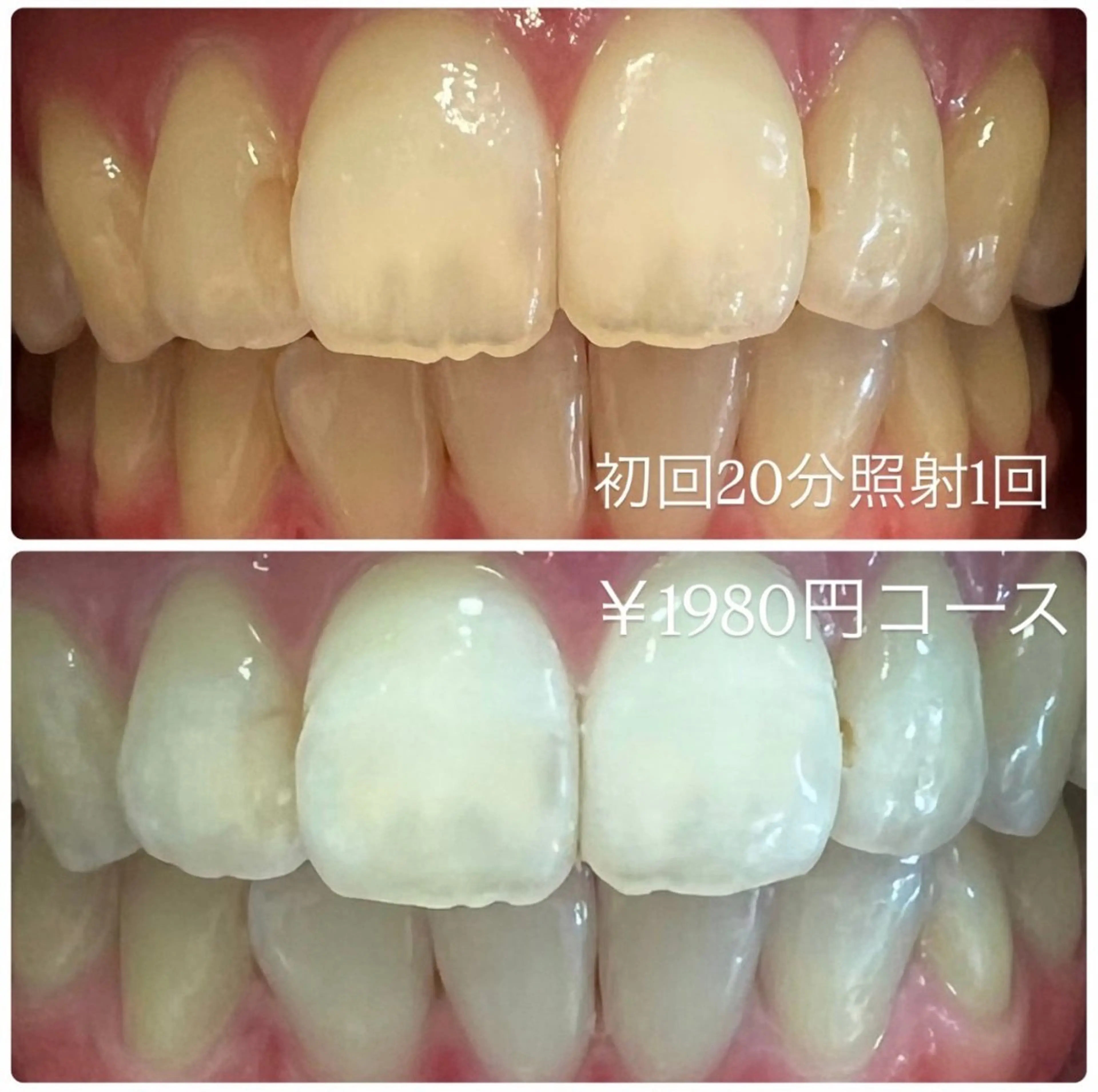 その他 PLATINUM Beauty 横浜店所属・ホワイトニングルーム 横浜店のその他イメージ