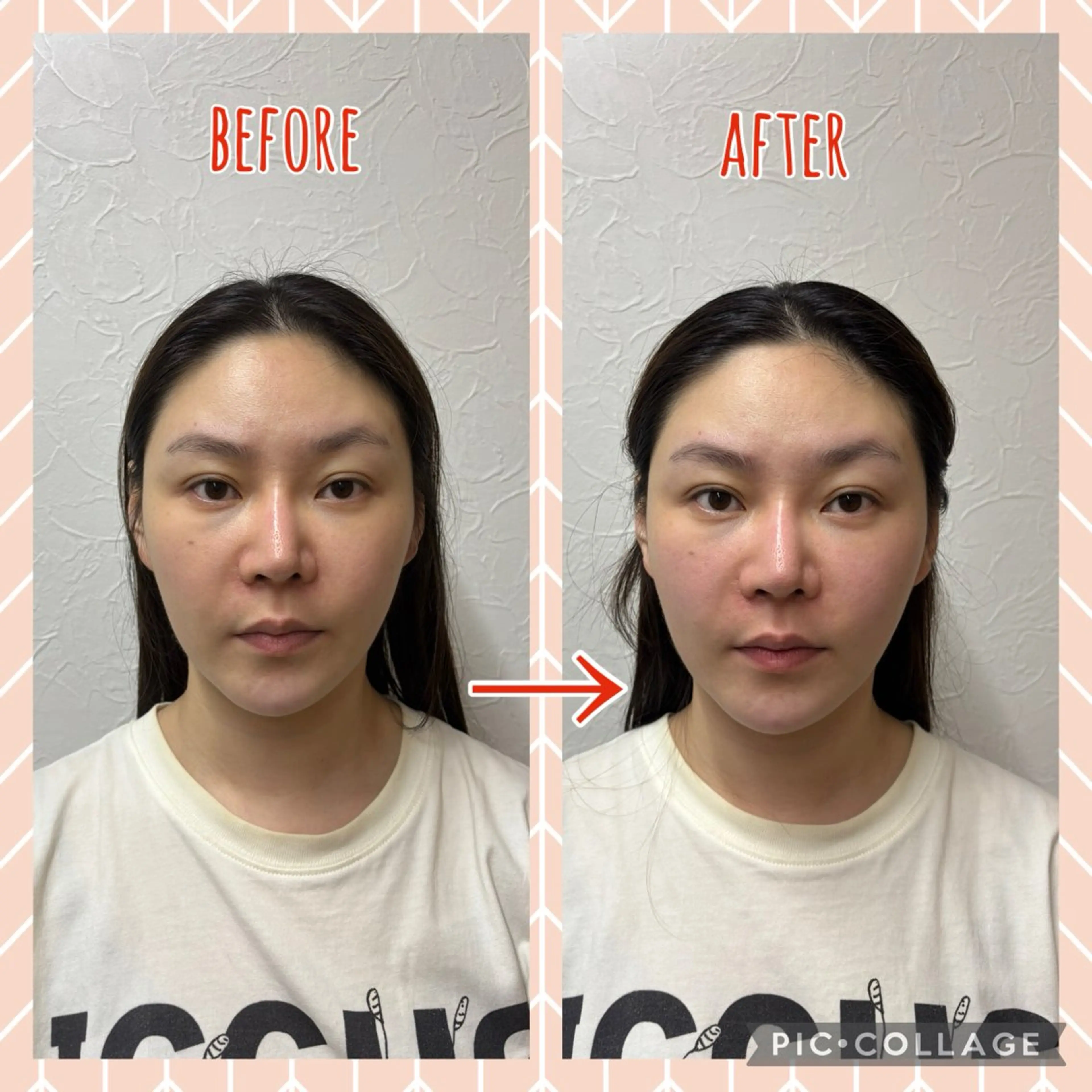 NO.10 整骨院のエステ・リラクイメージ