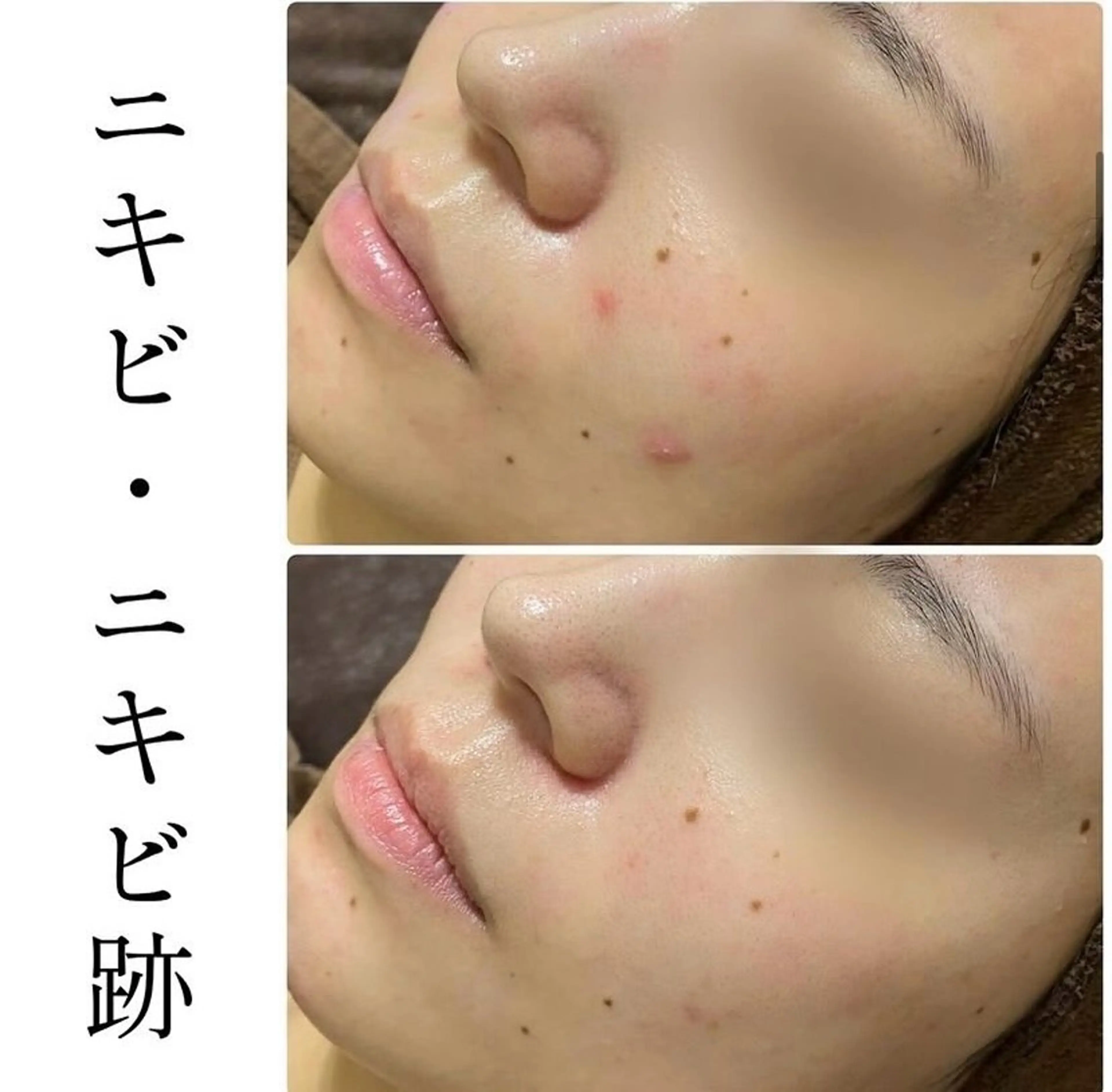 ハーブピーリング専門 BIOPLUS+川崎のエステ・リラクイメージ