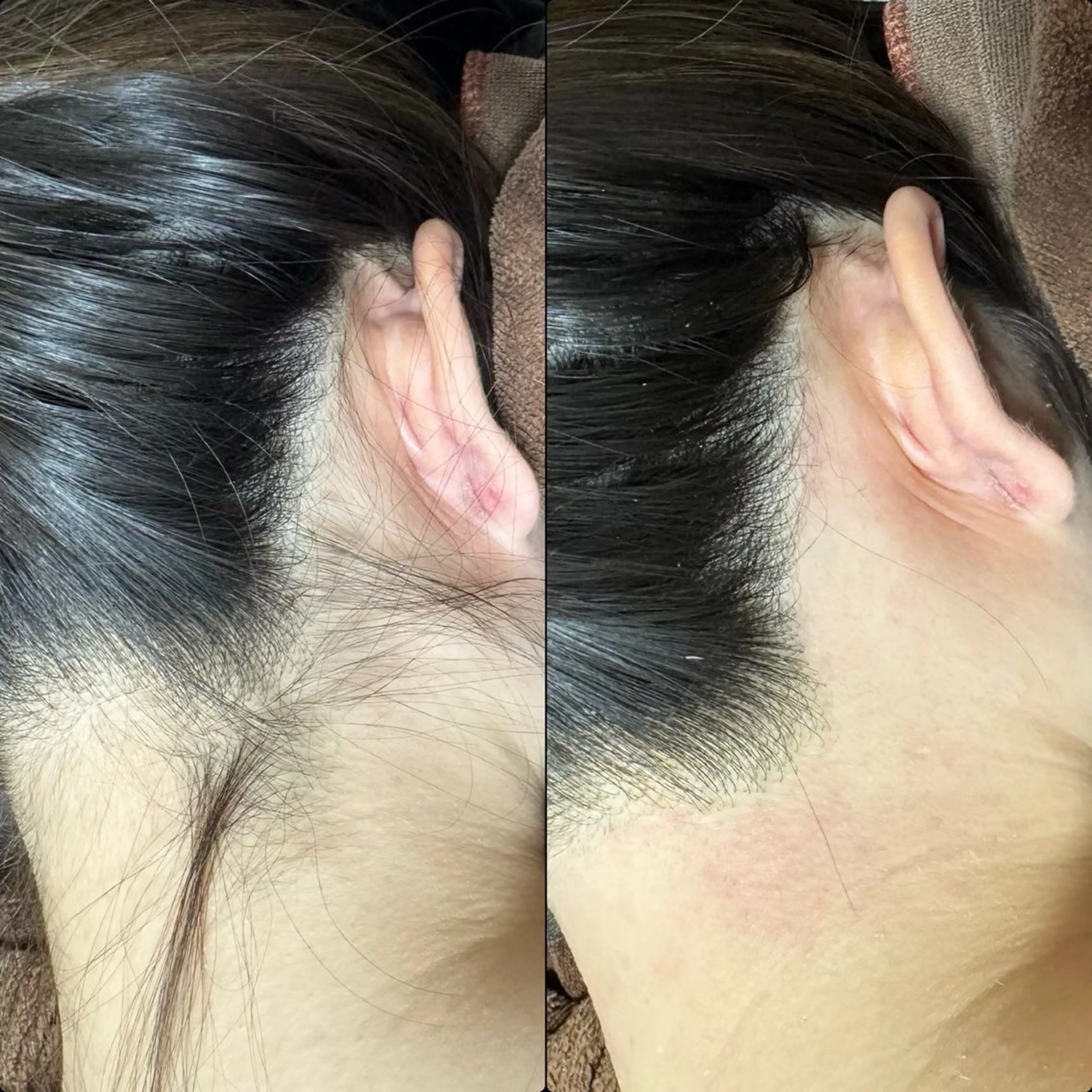 脱毛 六本木/似合わせ眉毛 andＳ🍀Yuriのエステ・リラクイメージ