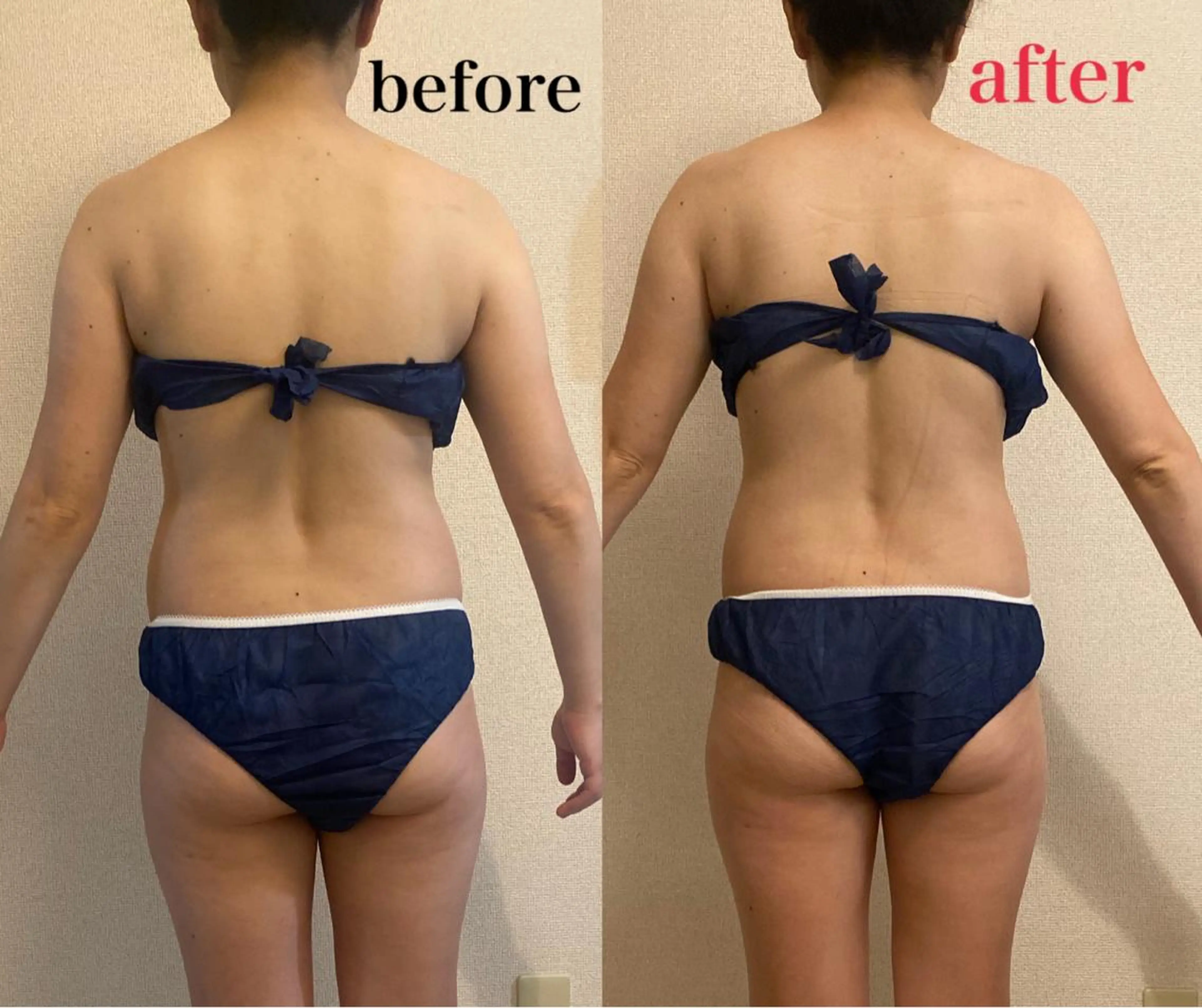 エステ リラク Salon de Lino 御器所のエステ・リラクイメージ