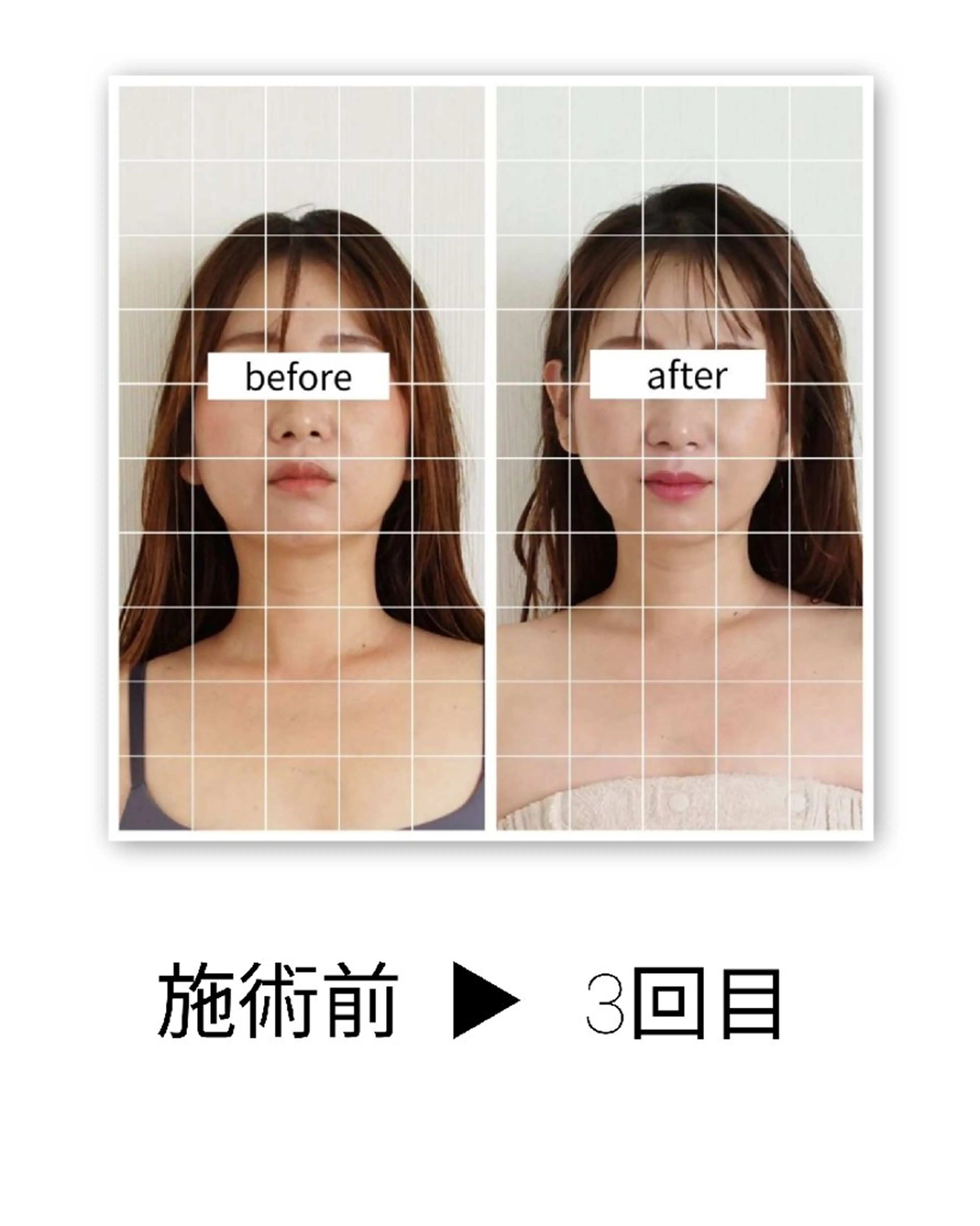 小顔矯正×フットケア(骨盤ケア) 【顔のたるみ、食いしばり、足のむくみが気になる方に】の写真