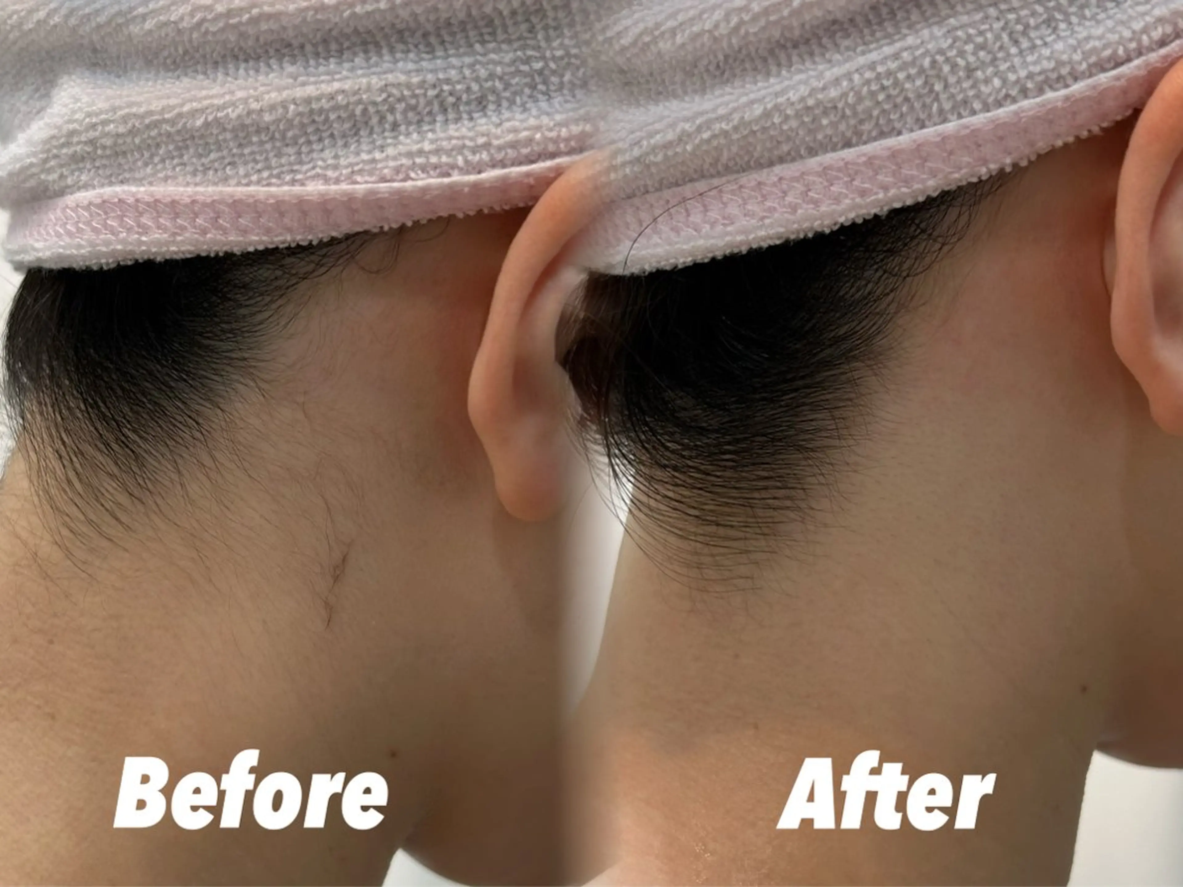 その他 🫧美しい素肌へ🫧 今成柚乃のその他イメージ