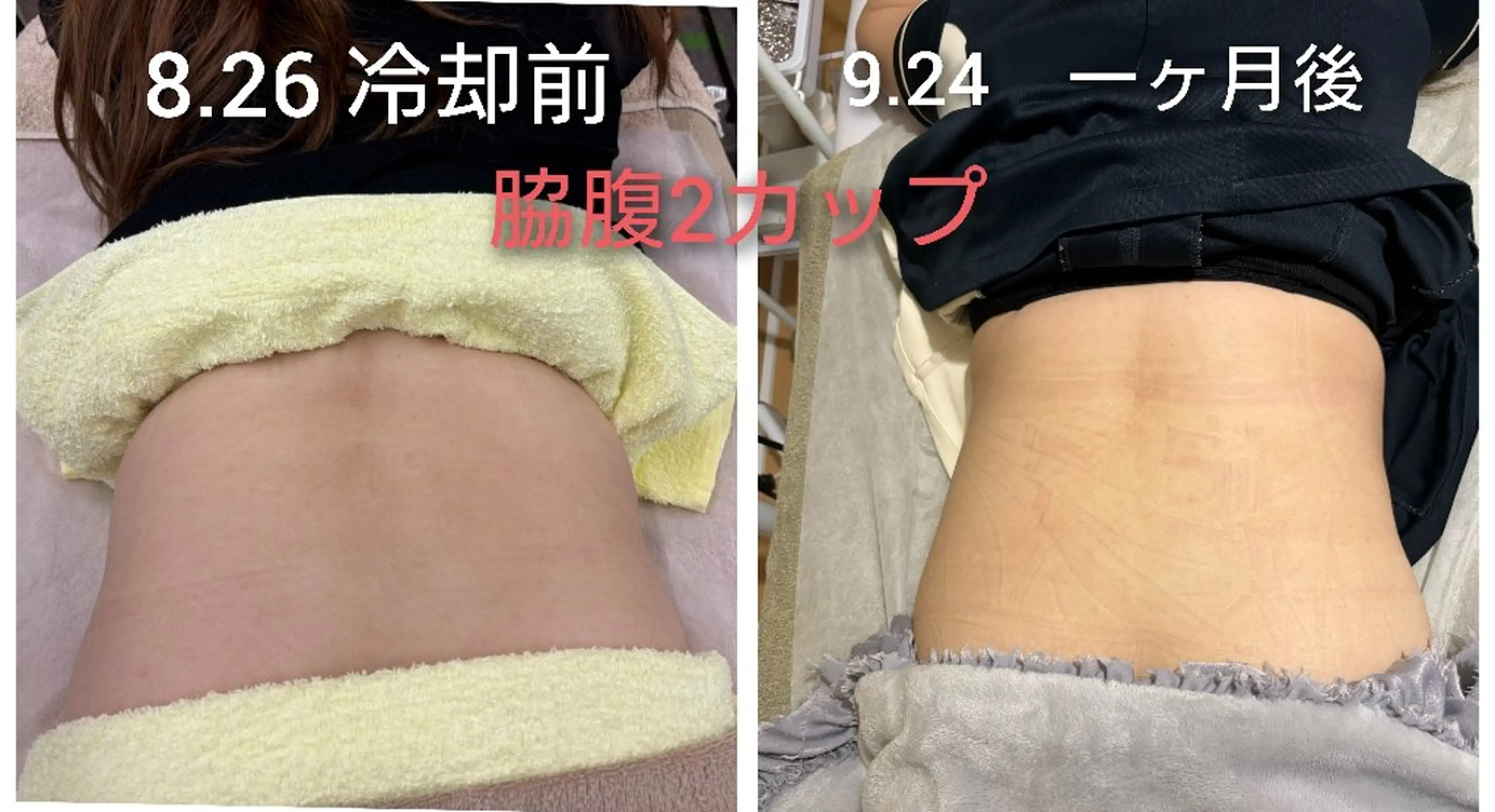 エステ Beauty Salon Luana所属・Luanaまつパ脱毛 ハーブピーリング眉毛のマツエク・マツパデザイン