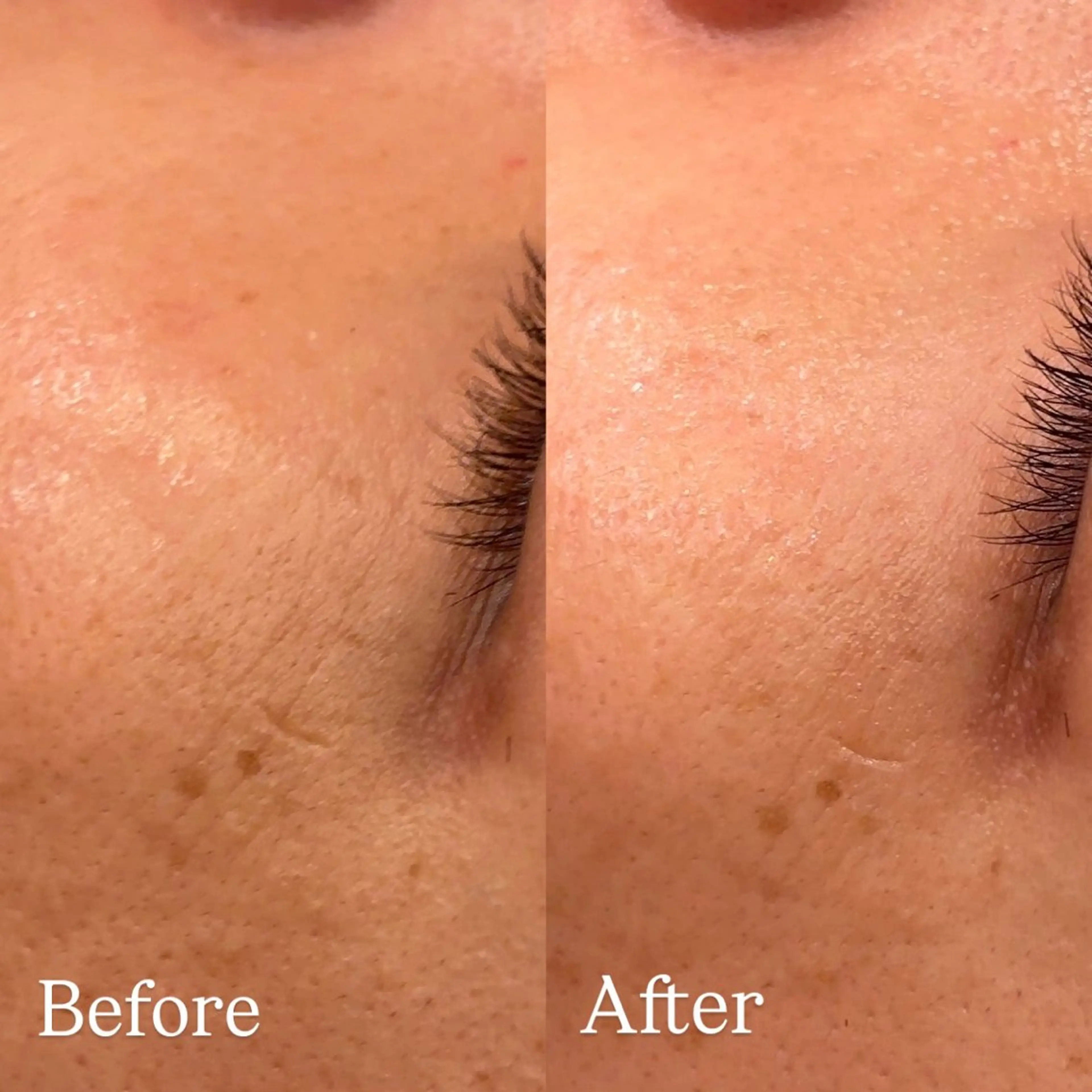 chika🦋 ハリラウンジ恵比寿のエステ・リラクイメージ