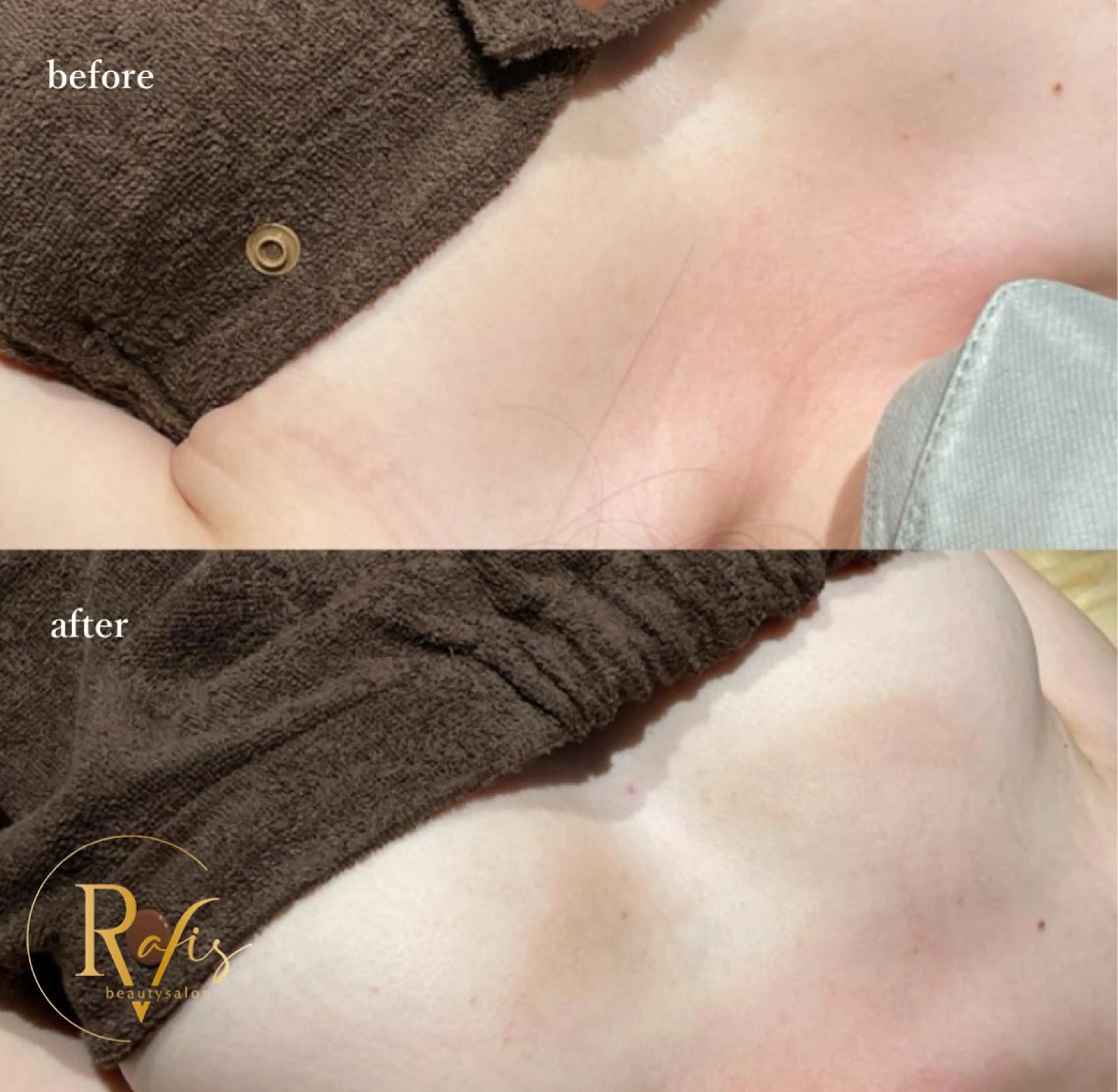 予約殺到‼️《光豊胸バスト💗》一瞬で驚きのふわふわボリュームup❣️ハリ、ボリューム感up✨️の写真