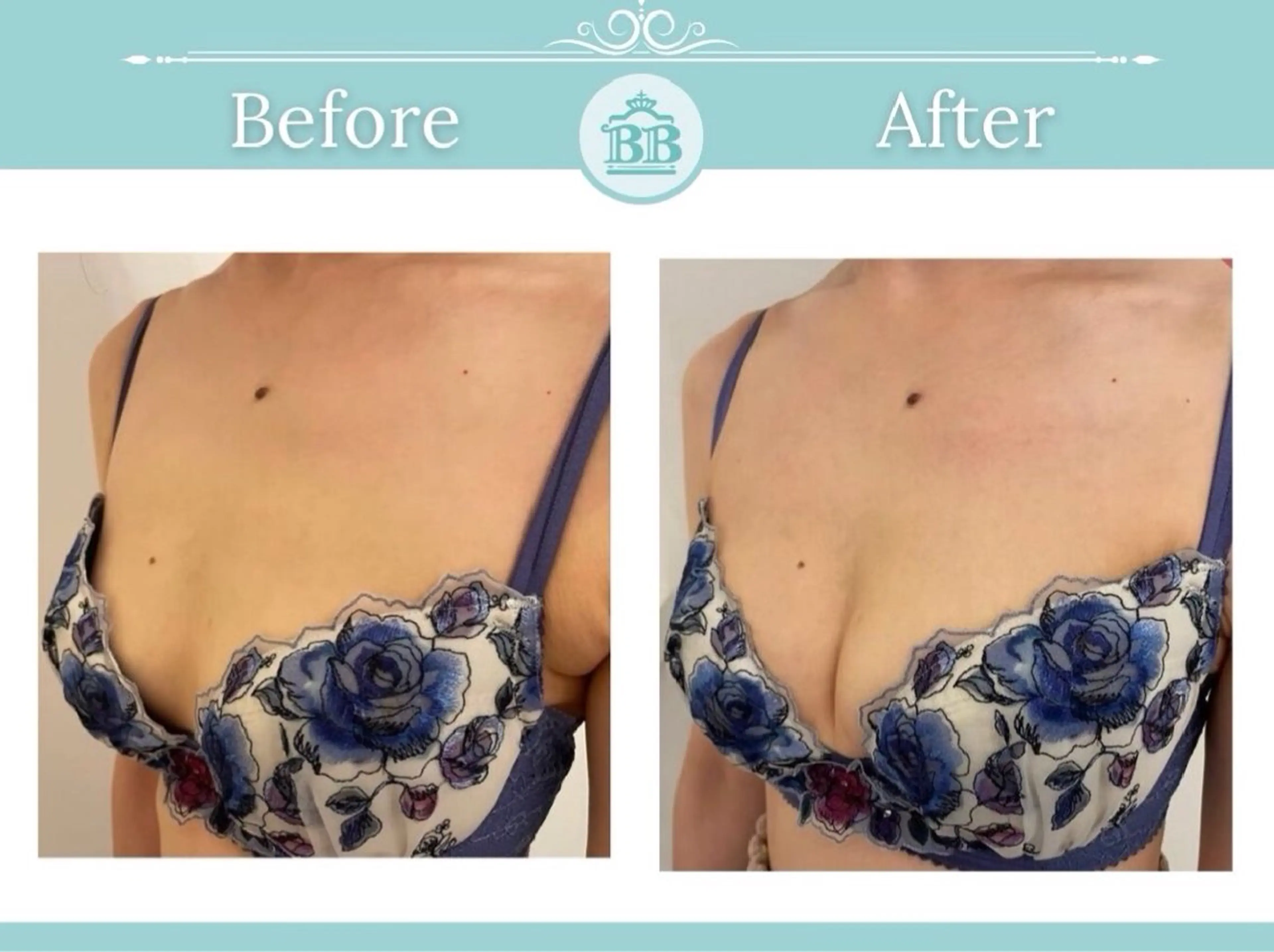 エステ 美人バスト 本厚木店のエステ・リラクイメージ