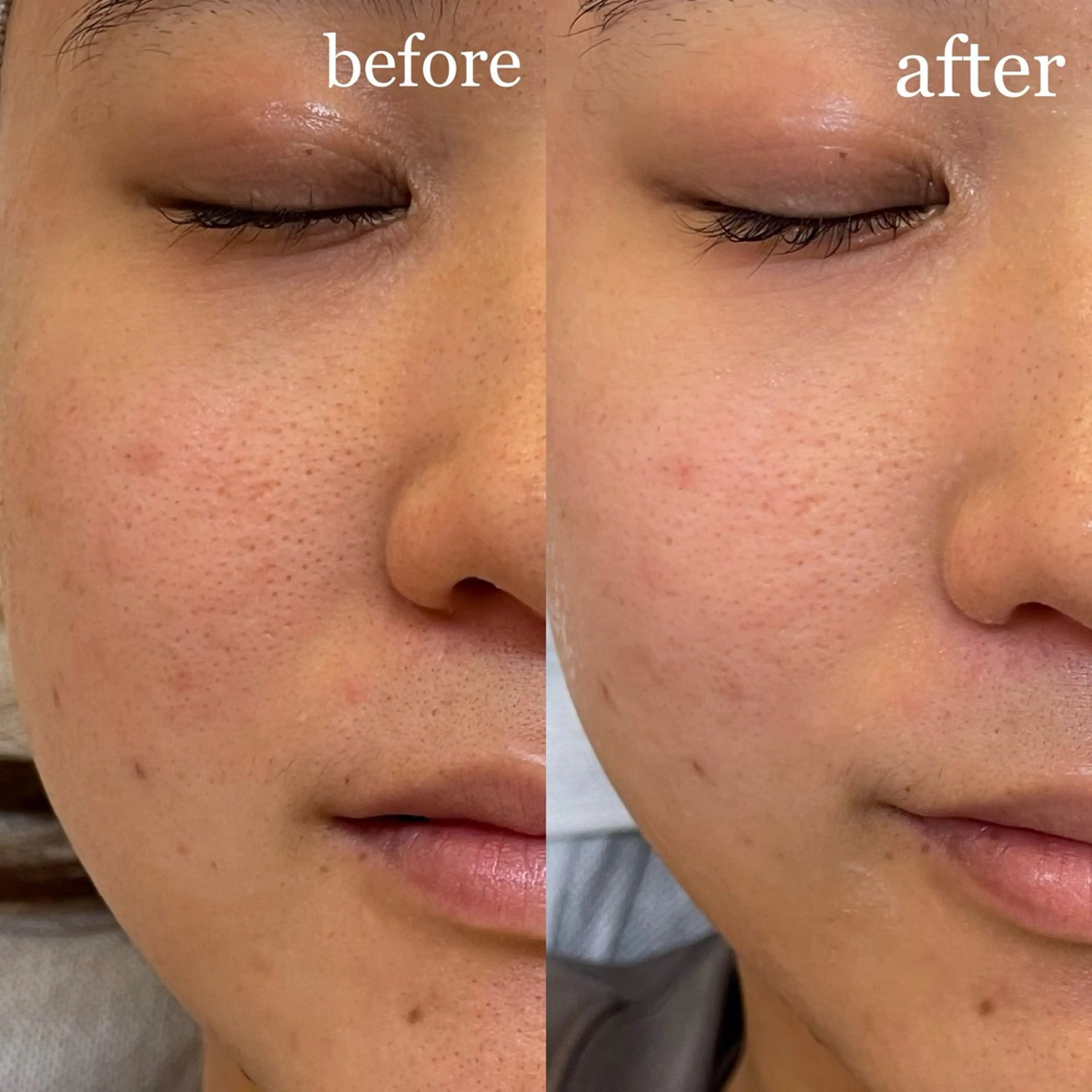 ナリスビューティサロン　デ･アイム長町所属・仙台エステDe'Im 長町🌿湯澤渚のエステ・リラクイメージ