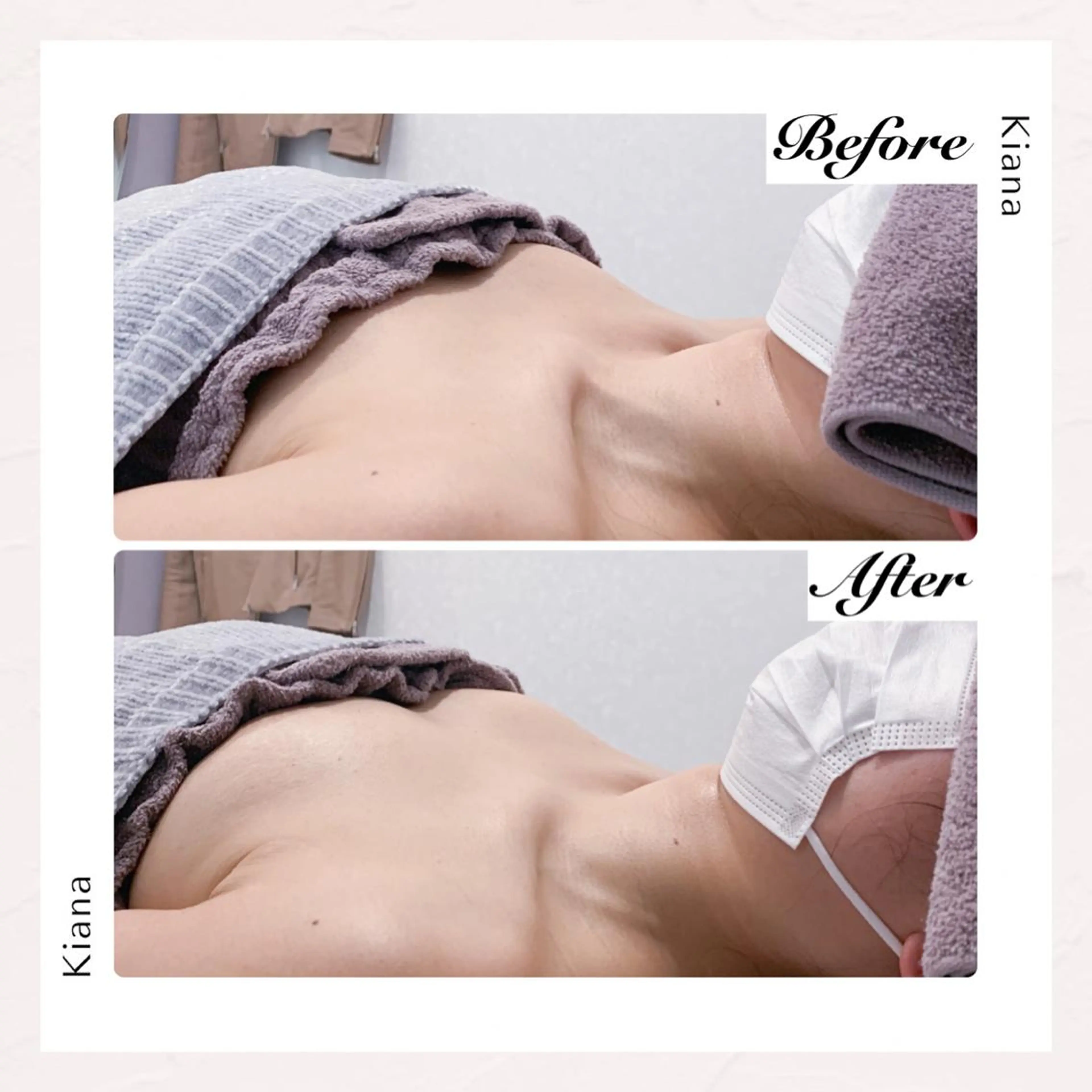 バスト専門Kiana 風のエステ・リラクイメージ