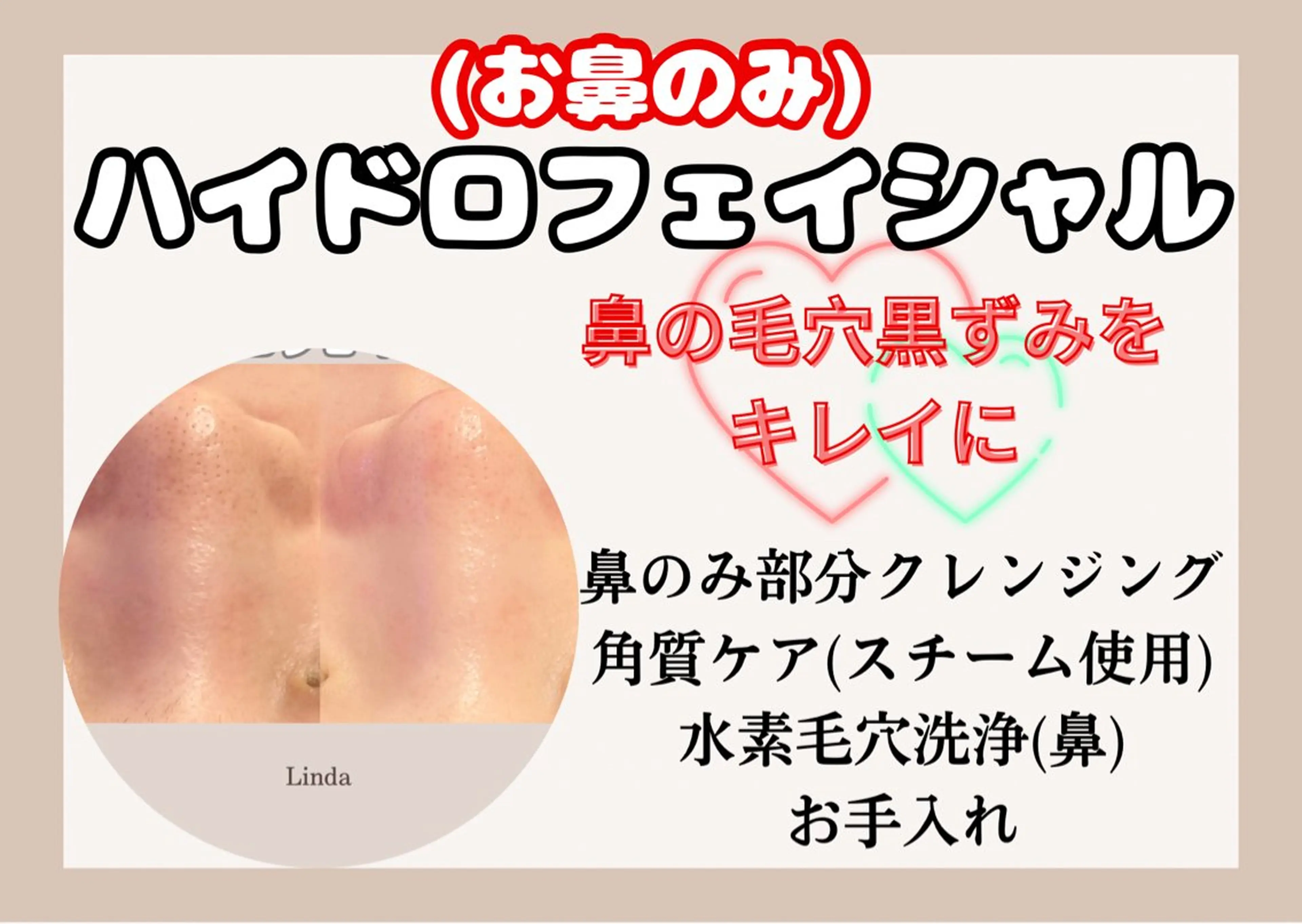 【鼻のみ】男女利用可◎毛穴詰まり・黒ずみざらつき徹底ケア☆の写真