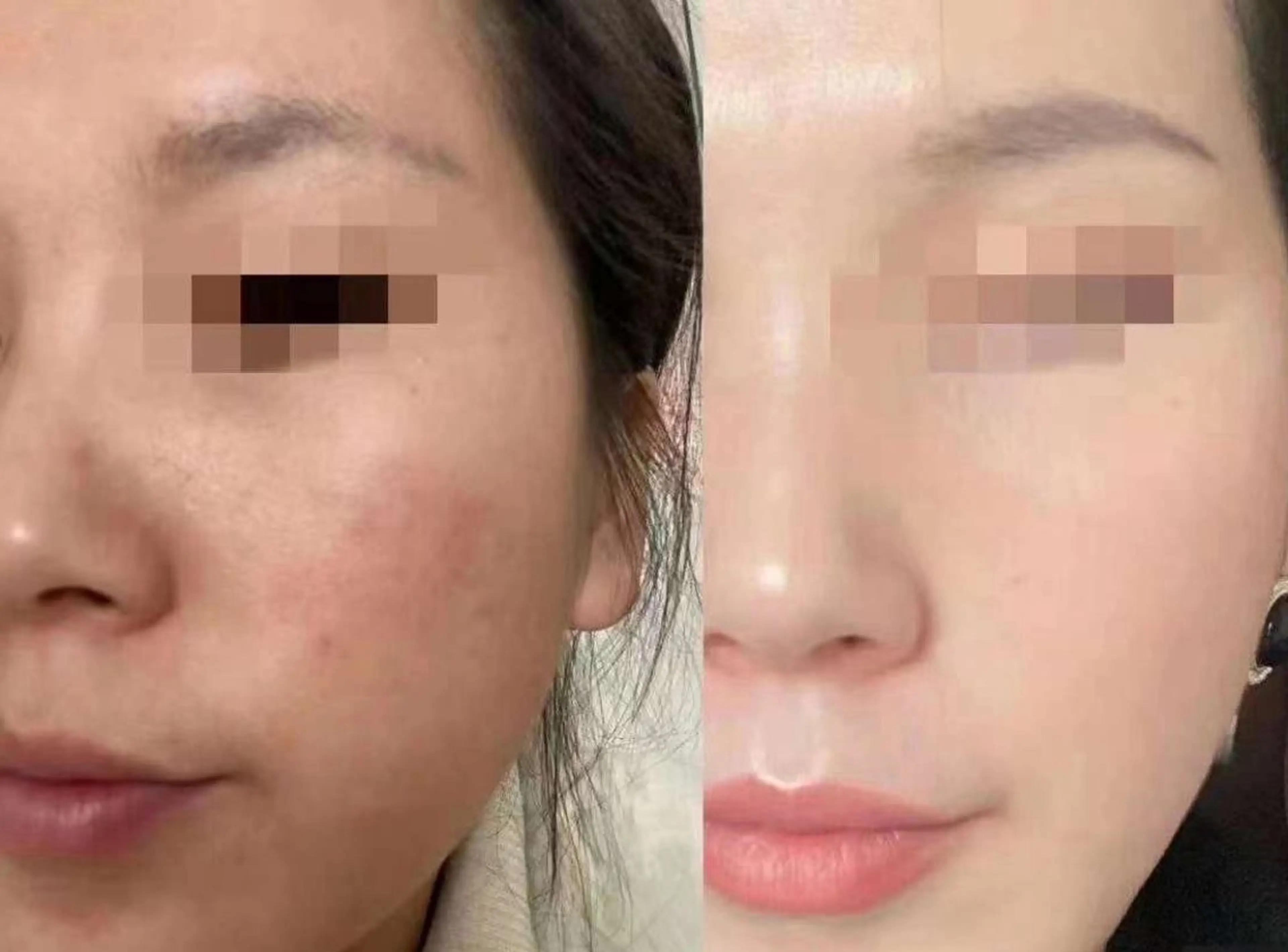 ネイル 韓国ネイル エステ aliaハーブ水光店 エステティシャン募集のエステ・リラクイメージ