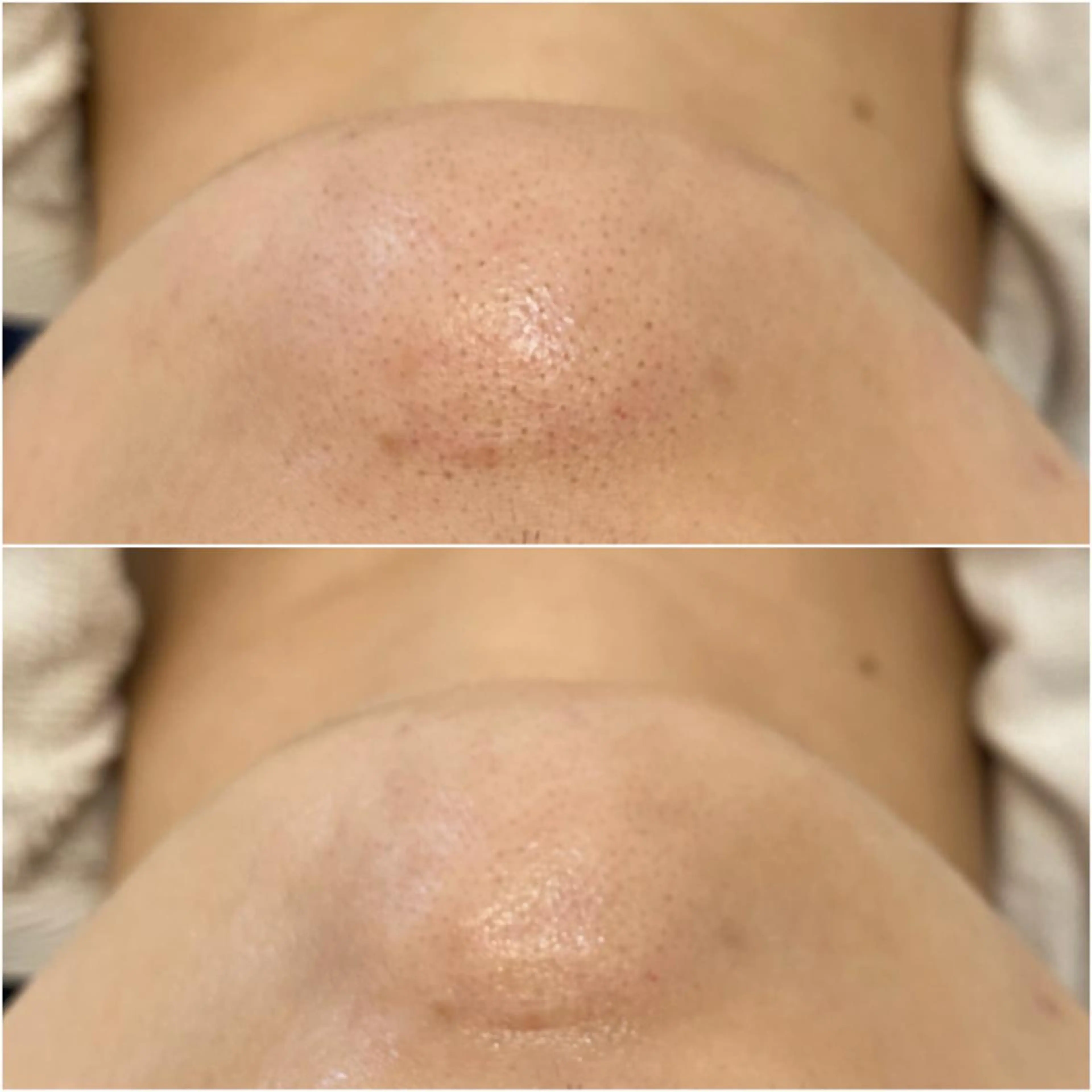 エステ ララ/ハーブ メゾンリュバンのエステ・リラクイメージ