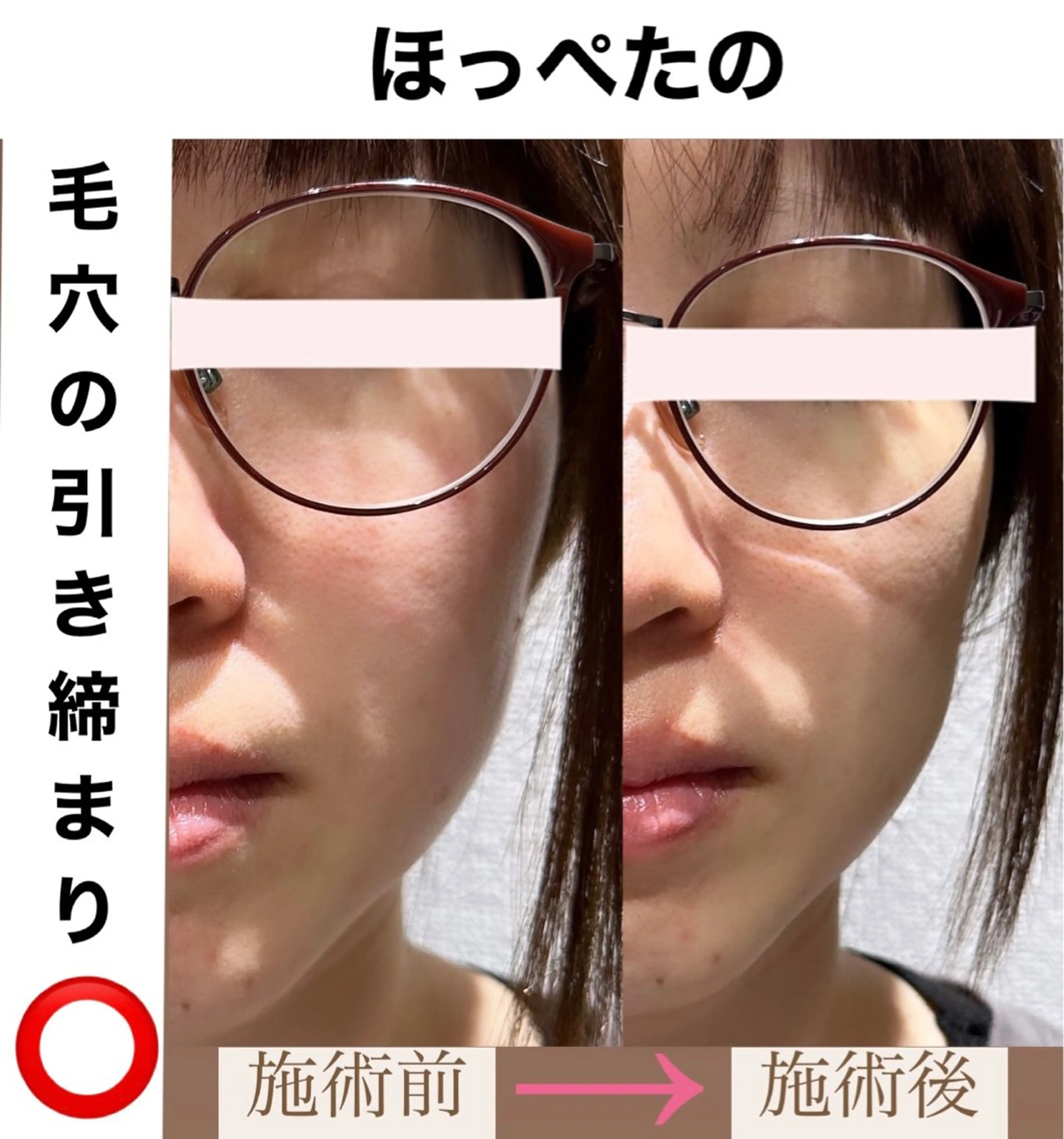 脱毛&美容サロン BLUESEAのエステ・リラクイメージ