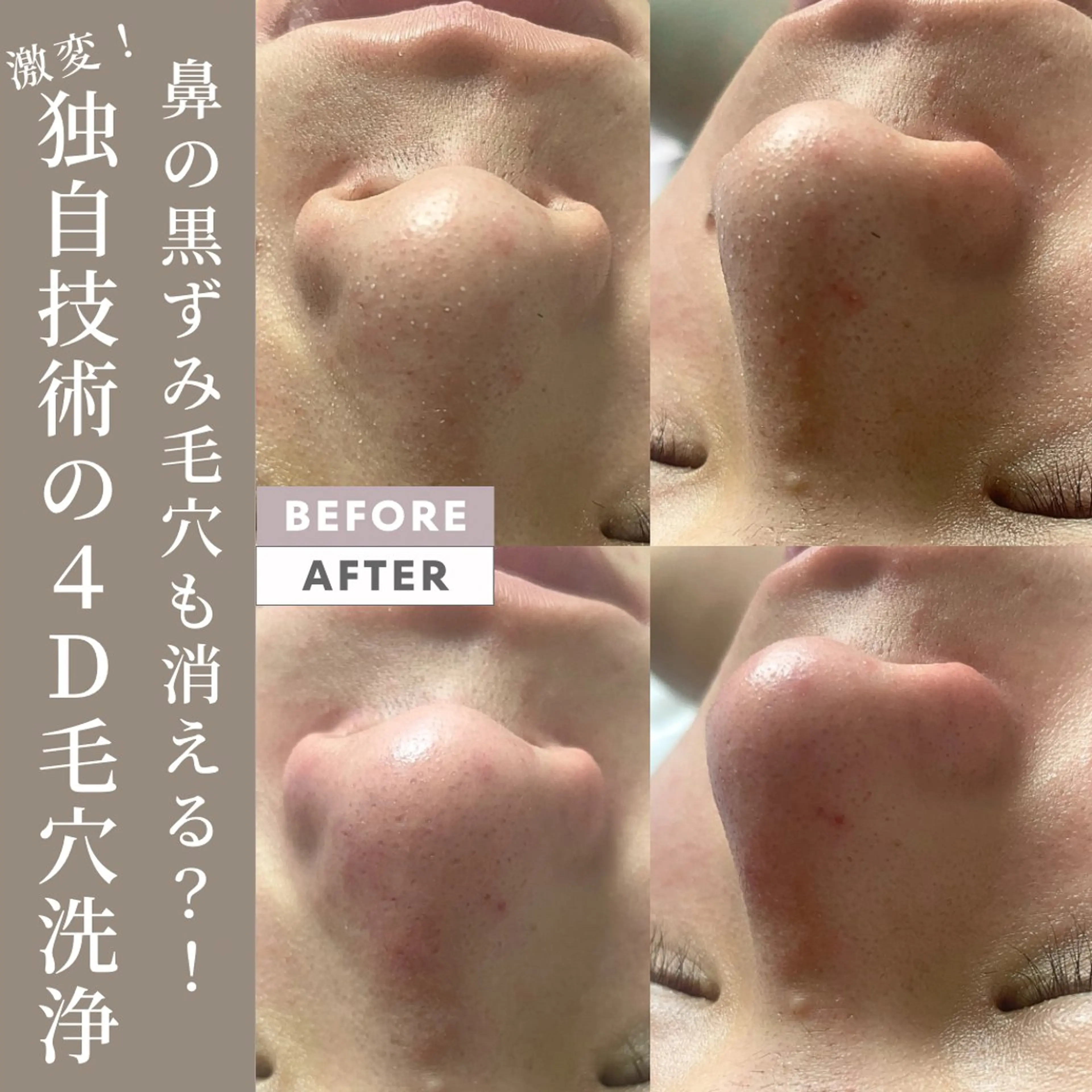 脱毛&増毛&肌管理サロンJemo所属・脱毛増毛肌管理サロン Jemoのエステ・リラクイメージ