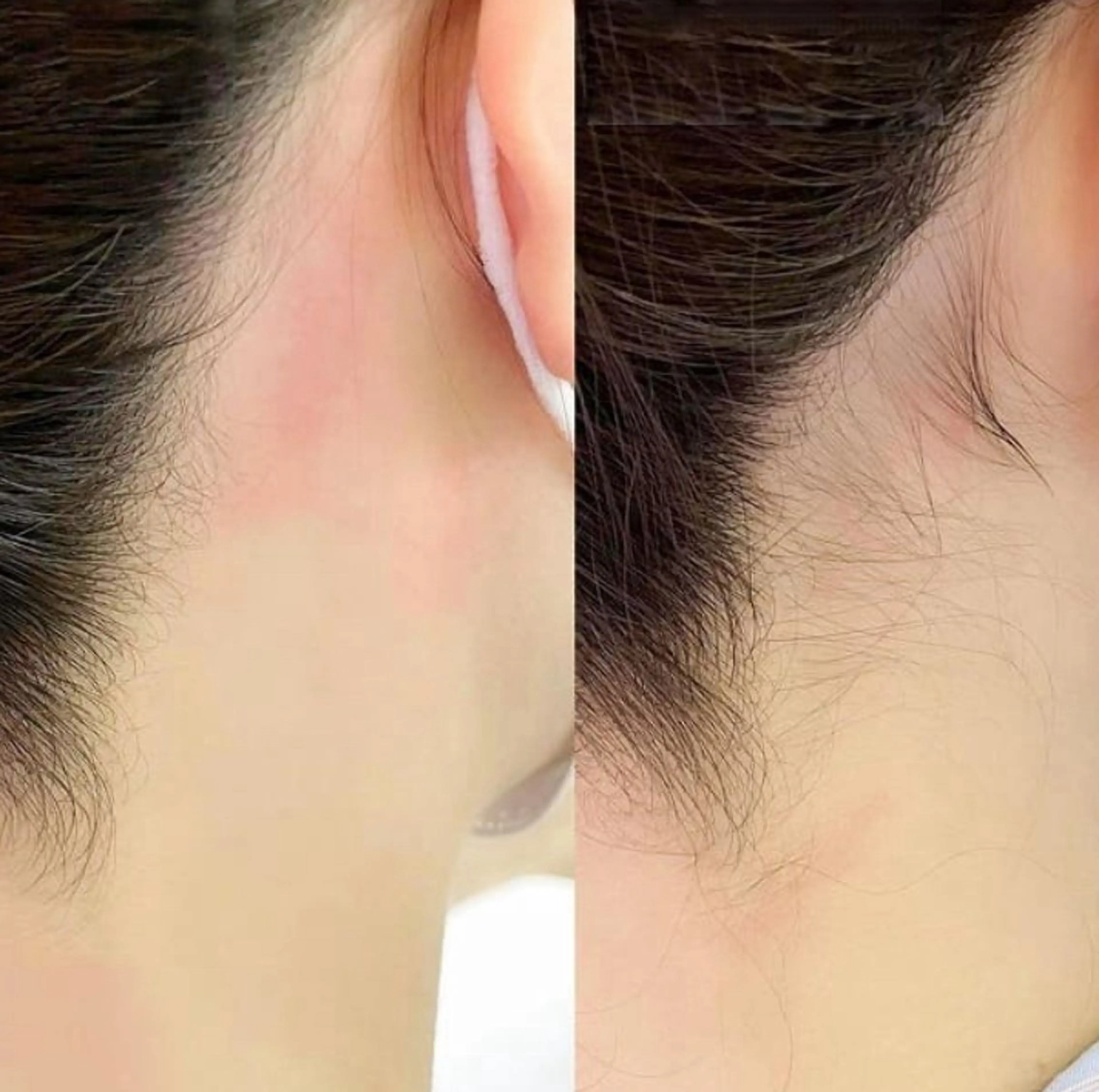 脱毛 サロンスワロー Marikoのエステ・リラクイメージ