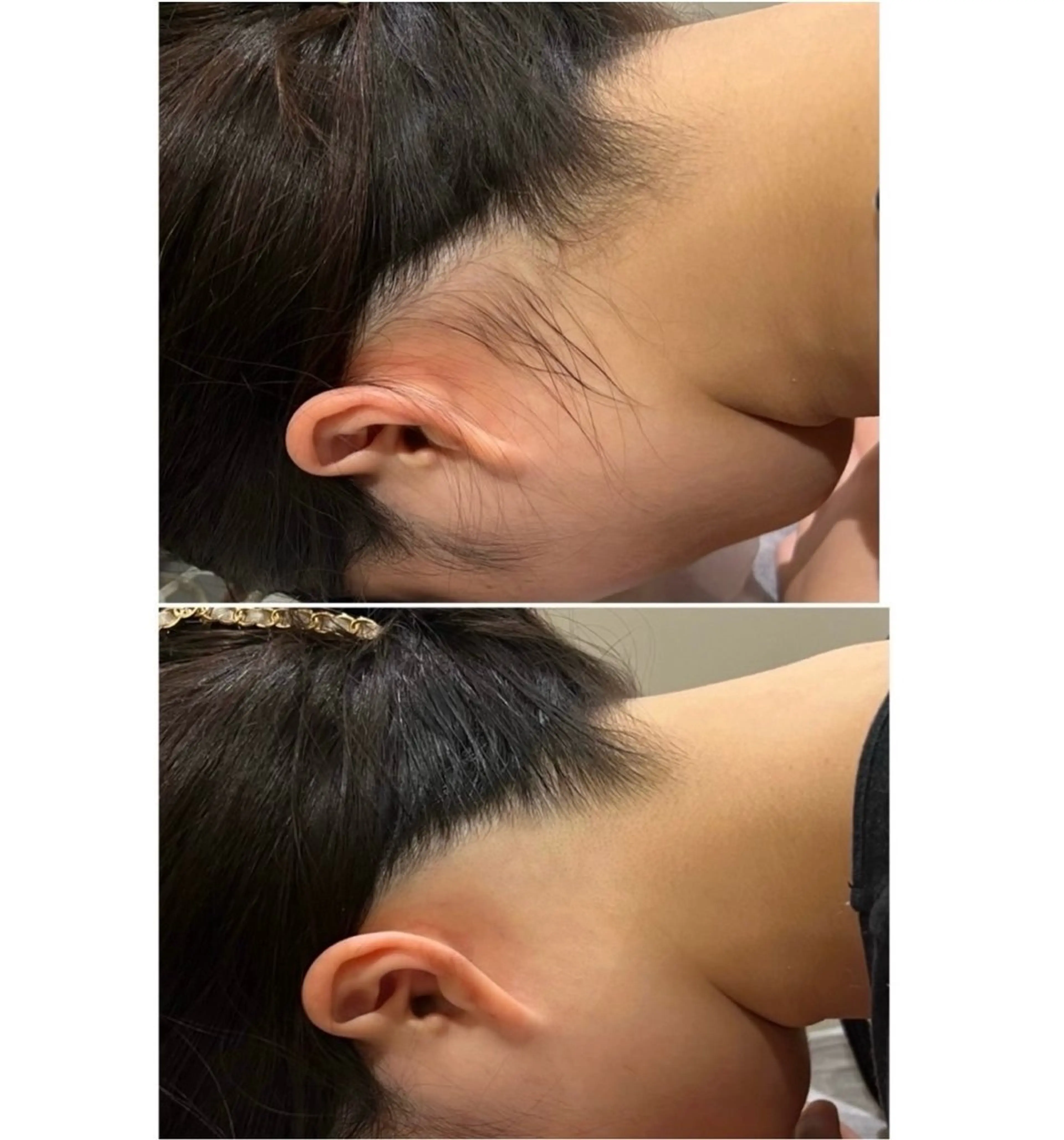 🍑実は見られています！あなたのうなじ🍑オーダーメイドメイドデザイン　シェービング付き　背中上部もついて2,750円の写真