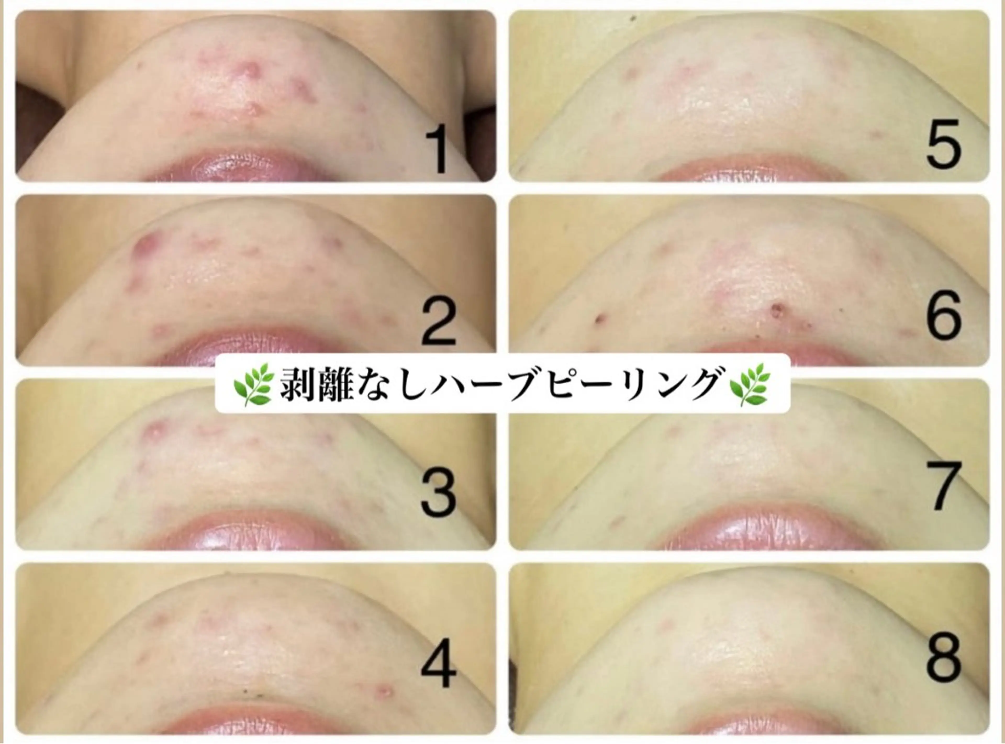 エステ 脱毛／肌質改善 《ulula~梟》のエステ・リラクイメージ