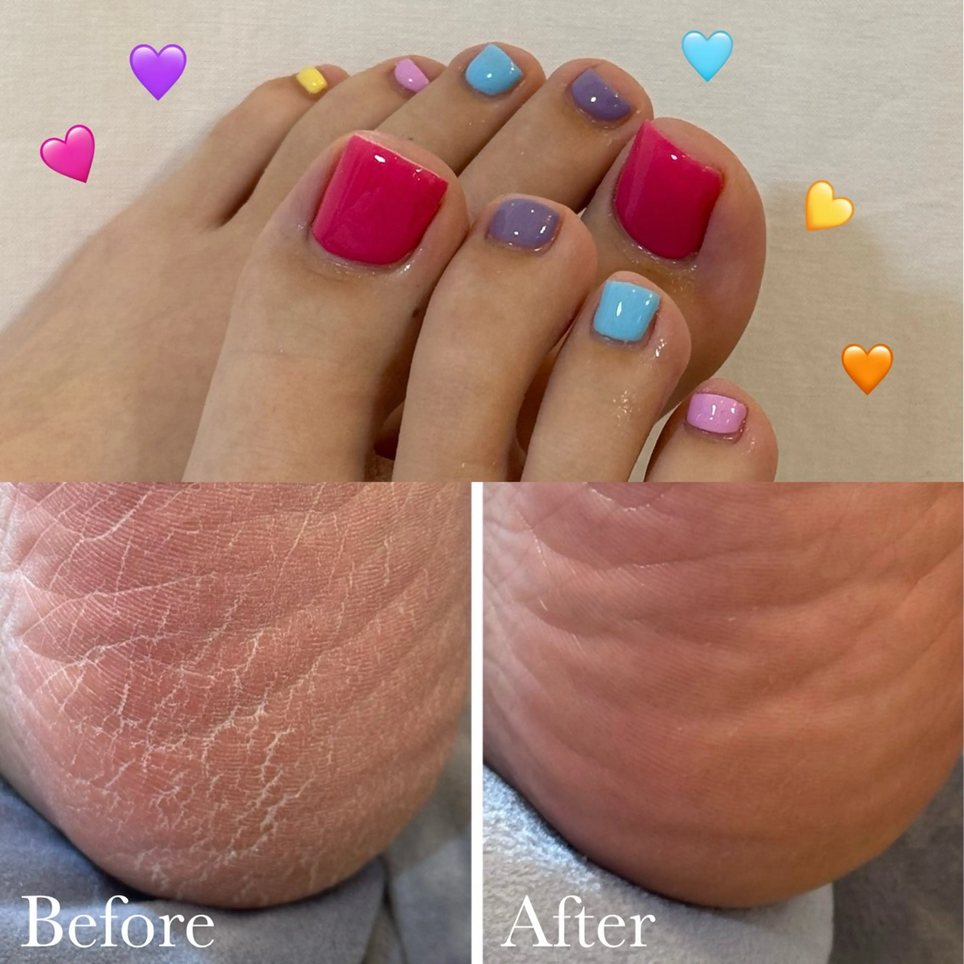 特別クーポン❣️【フィルインオフ込】✨フットワンカラー＋極上つるすべ踵ケア✨の写真