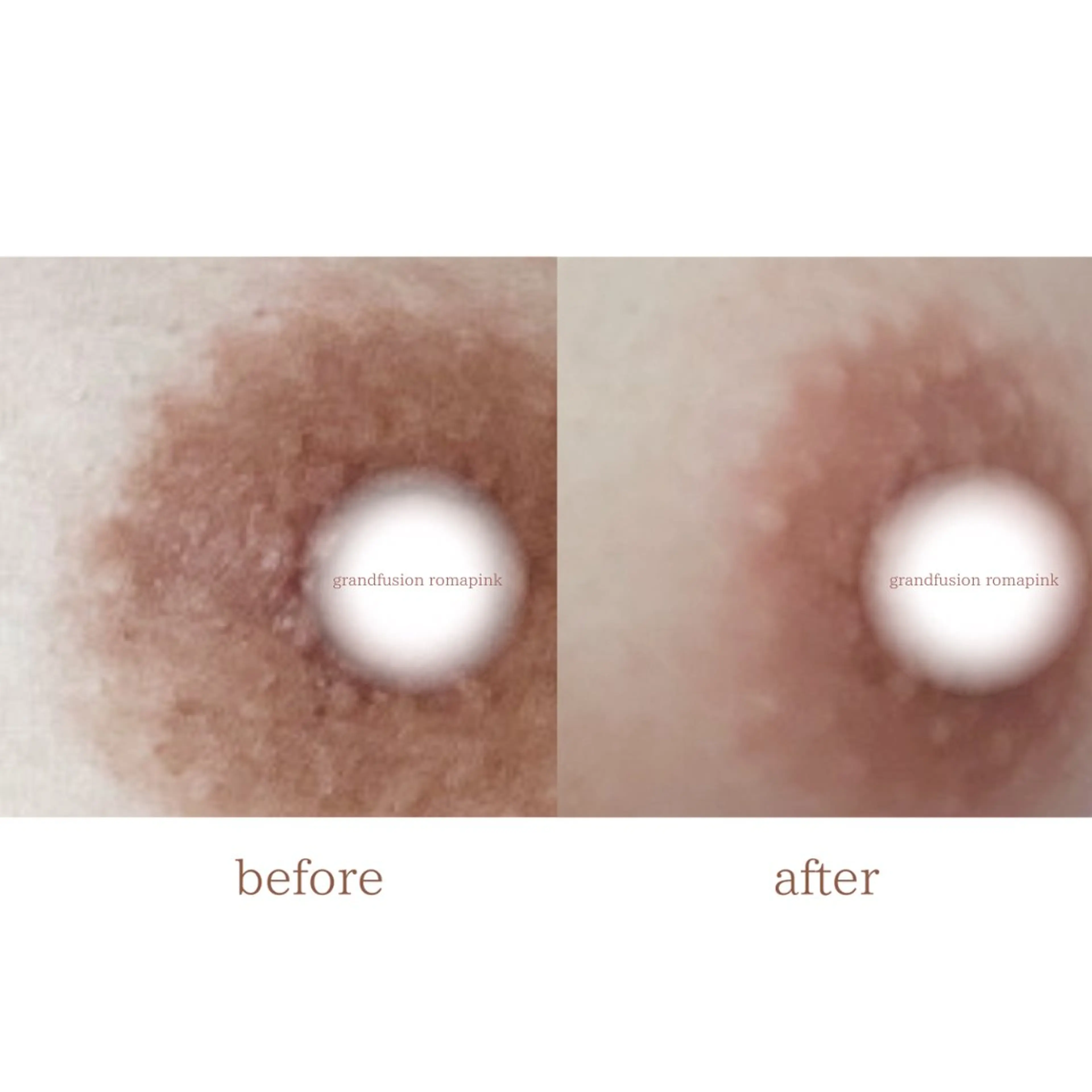 Raviy 【痩身・韓国肌管理】のエステ・リラクイメージ