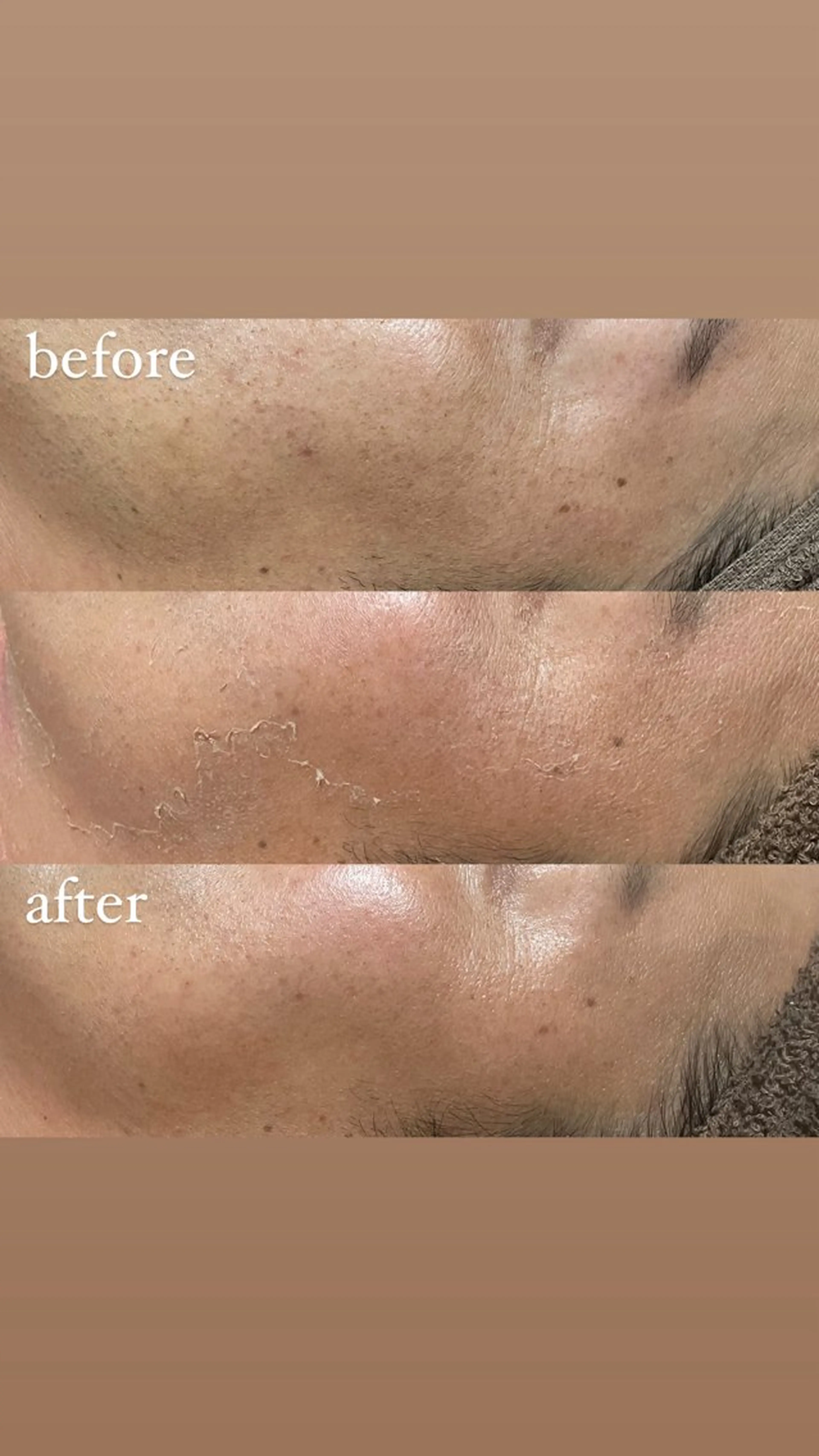 エステ 老化肌トラブル肌専門 Brillianceのエステ・リラクイメージ