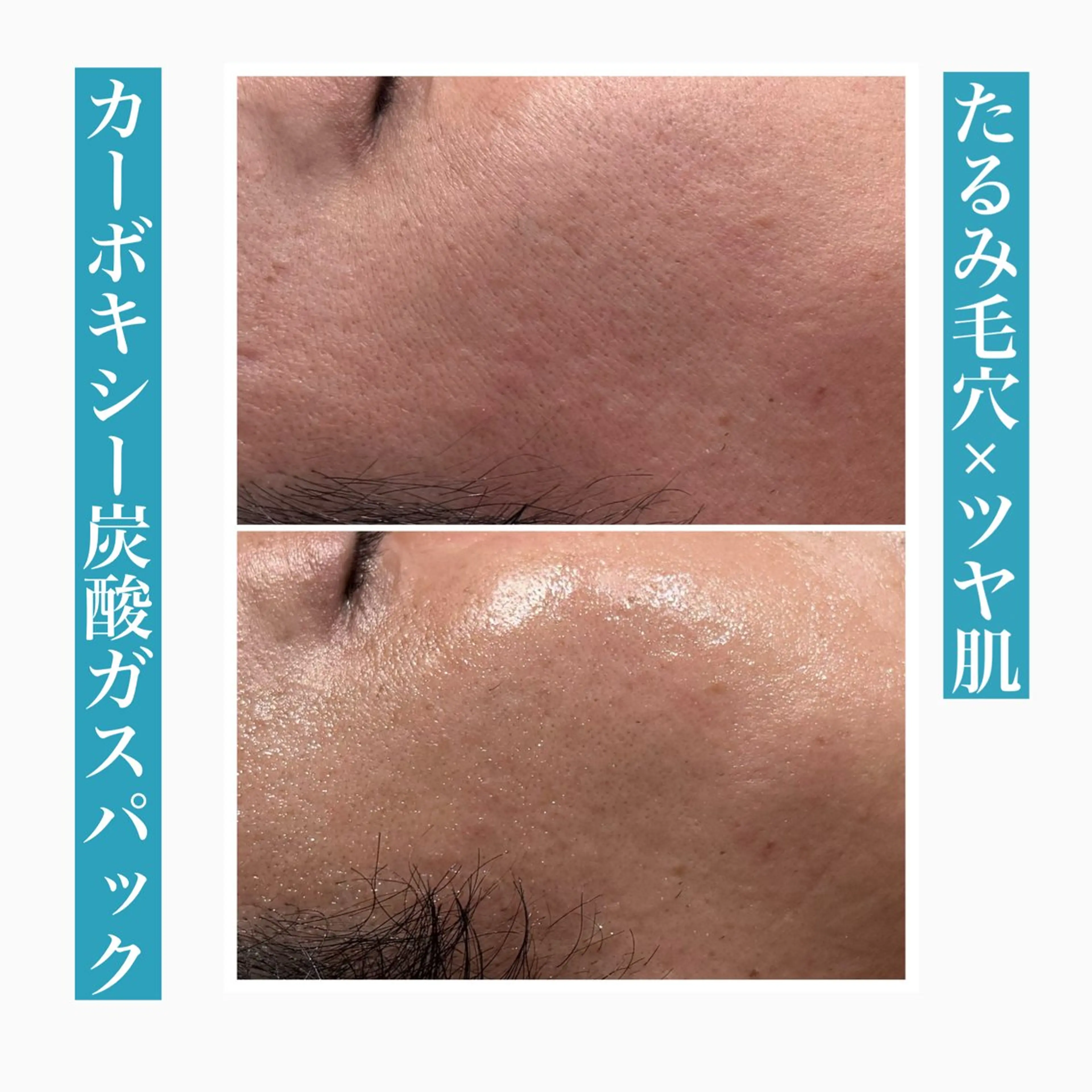 エステ beautysalon RAVIS所属・東大阪/韓国肌管理/ 痩身バスト専門店のエステ・リラクイメージ