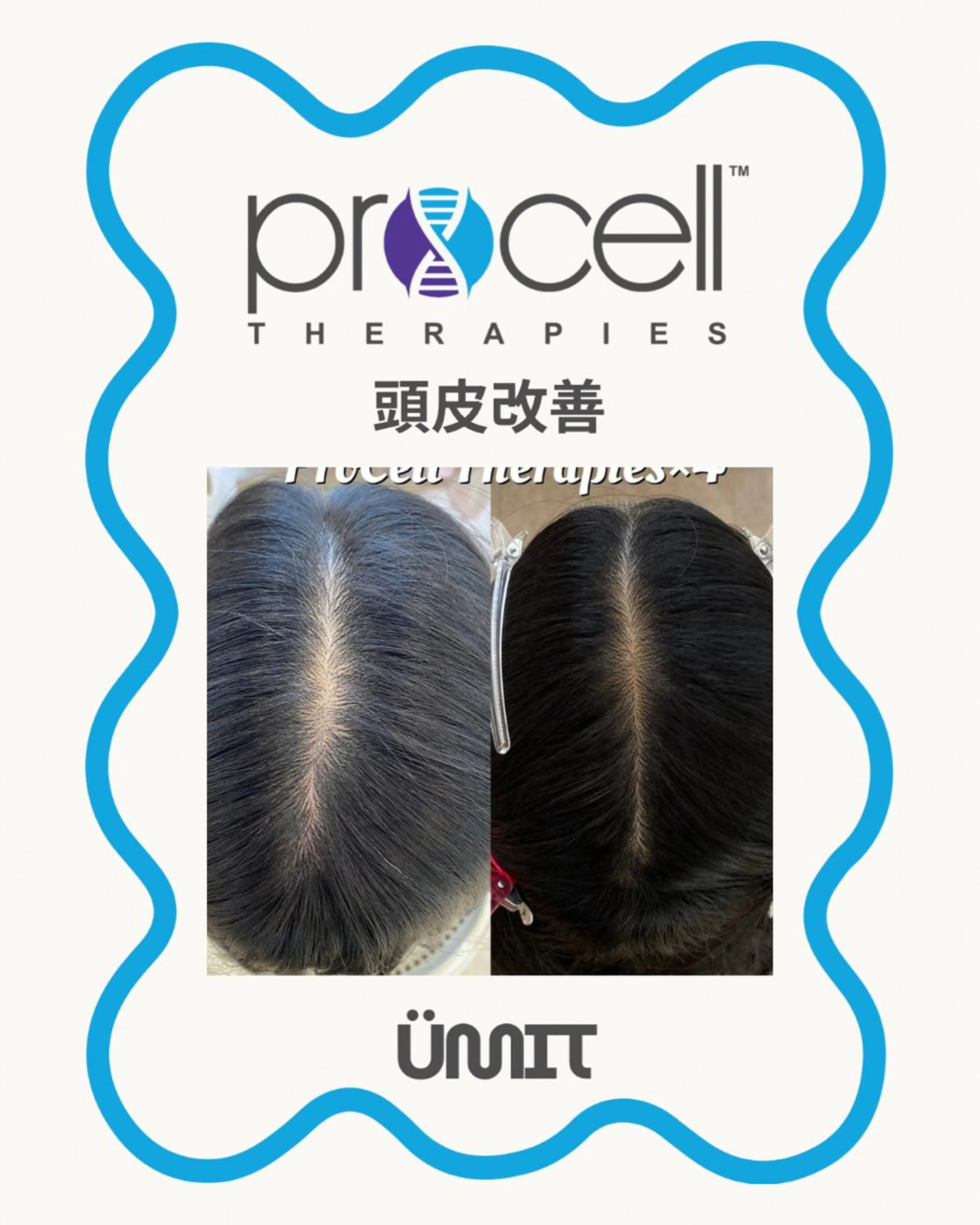 ヘッドスパ Ümit（ユミト） プロセルセラピーズのネイルデザイン