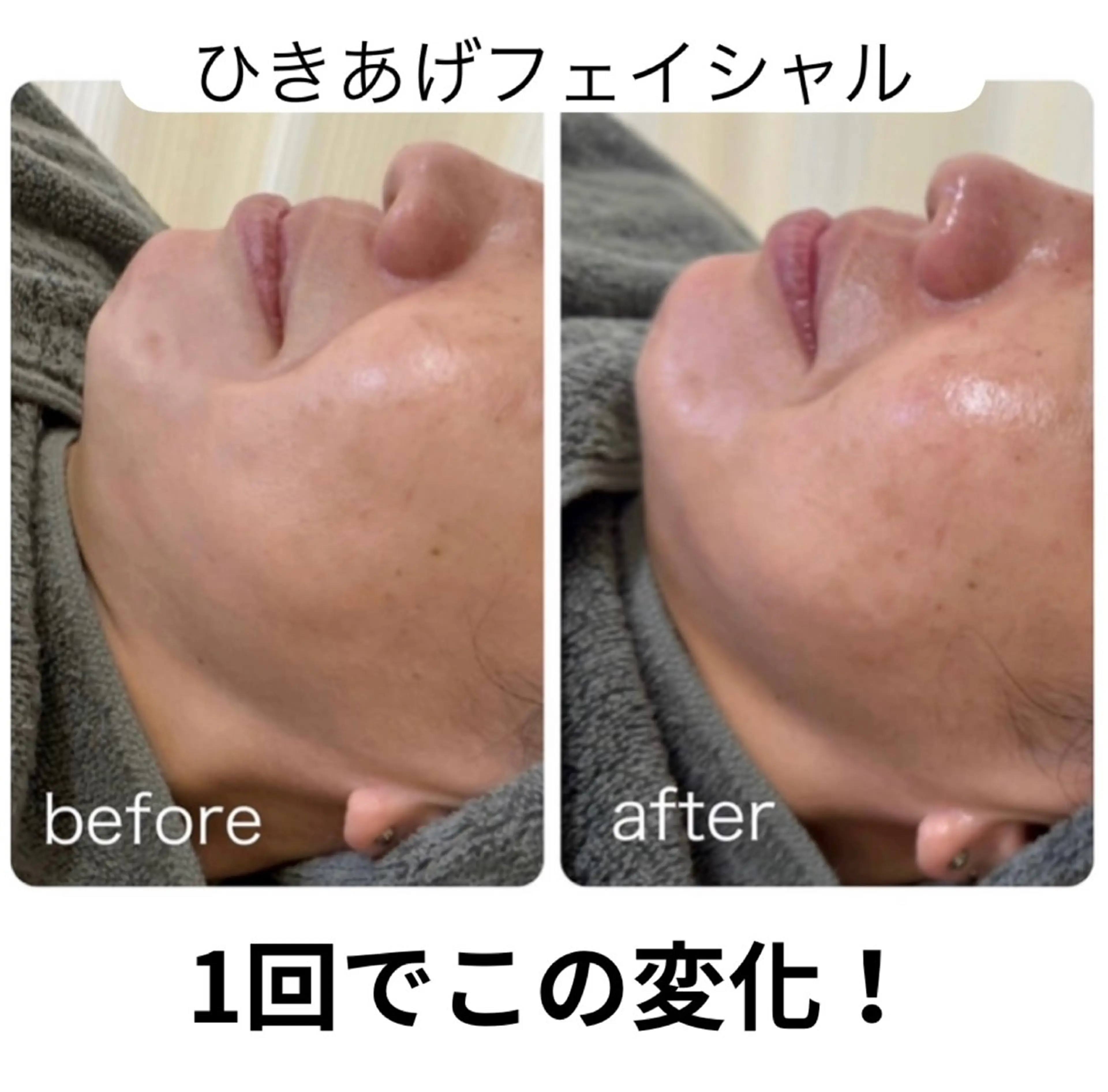 ほねつぎ一休さん 宇品店のエステ・リラクイメージ