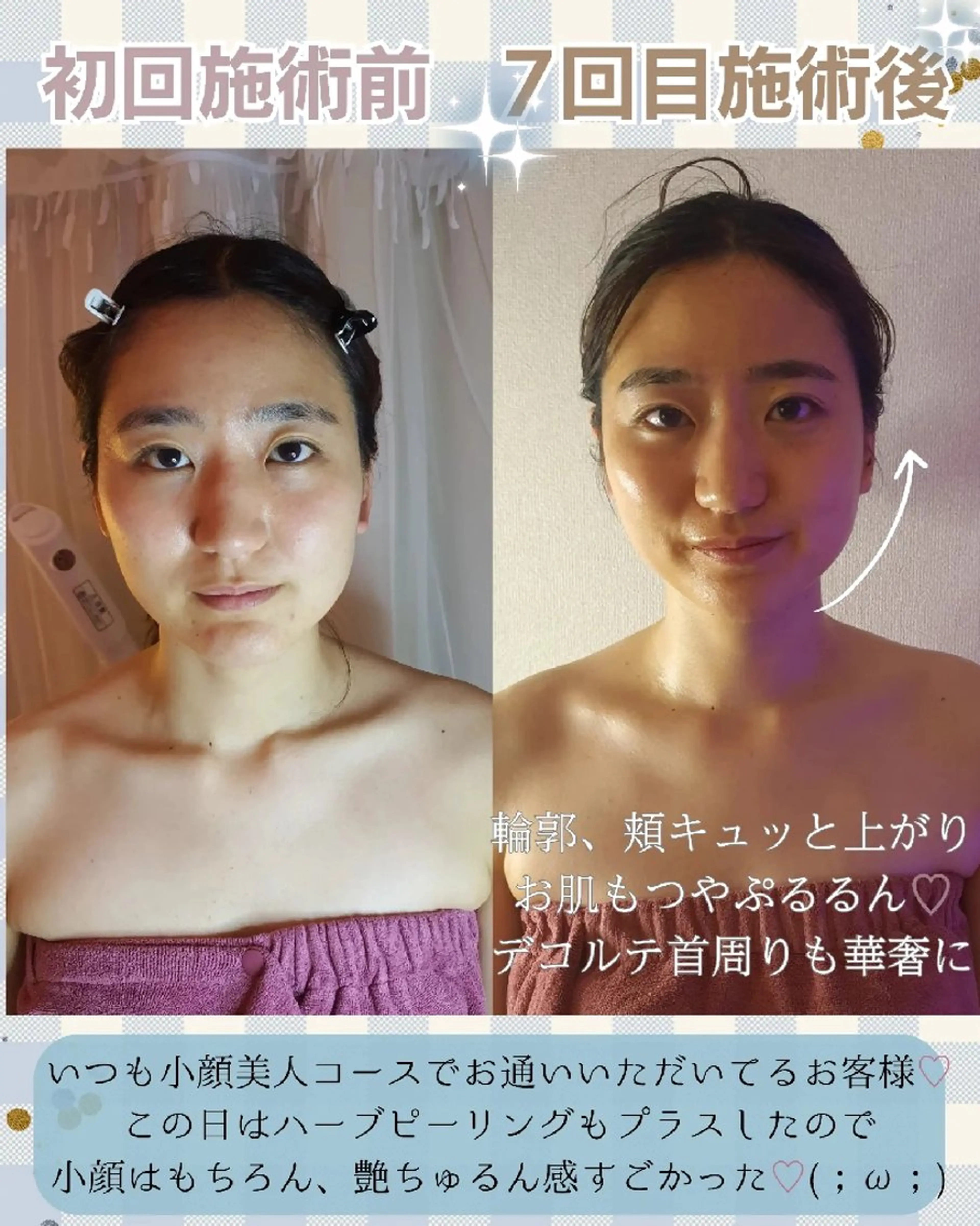 痩身ハーブピーリング 筋膜リリース☆B&Hのエステ・リラクイメージ