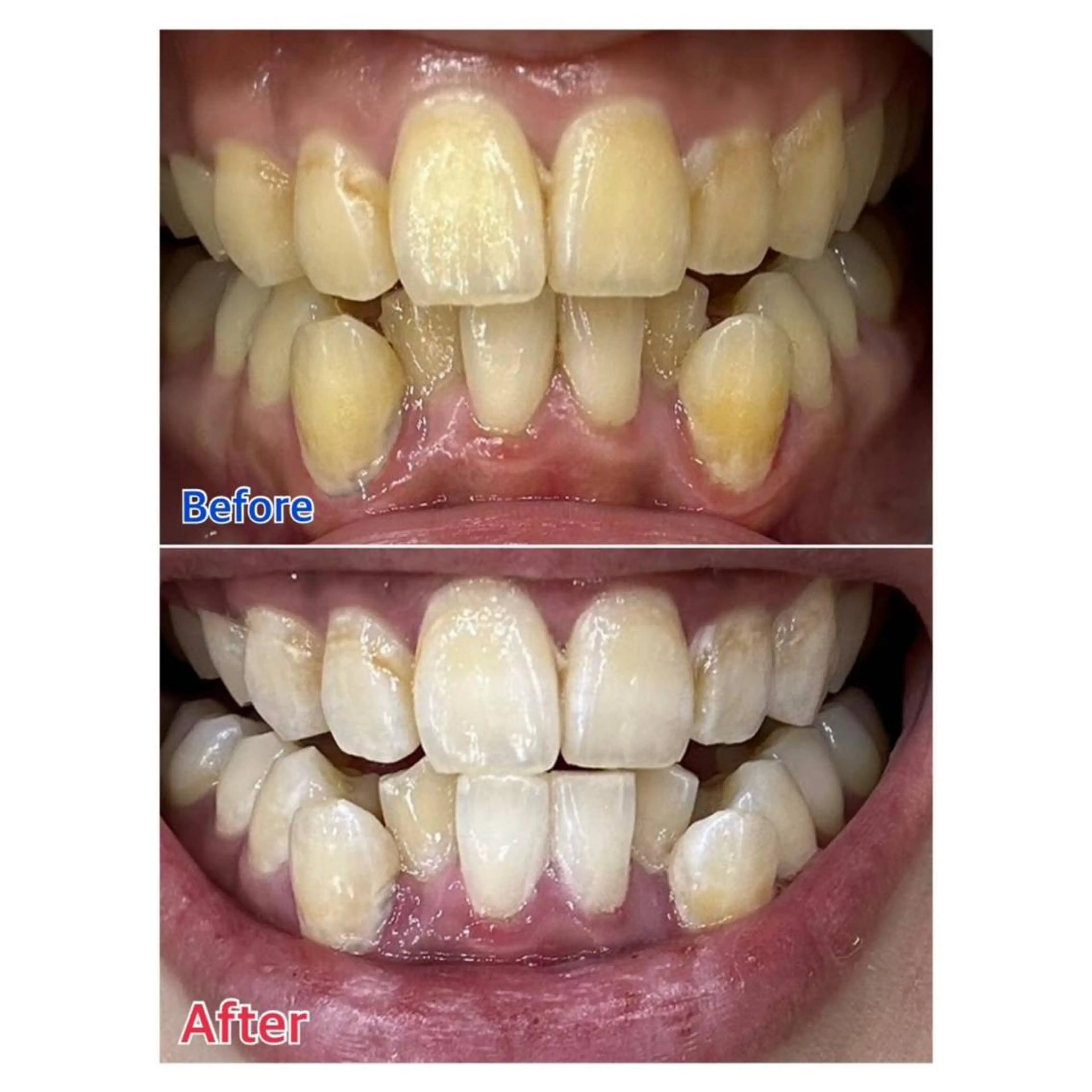 Melty 輝のその他イメージ