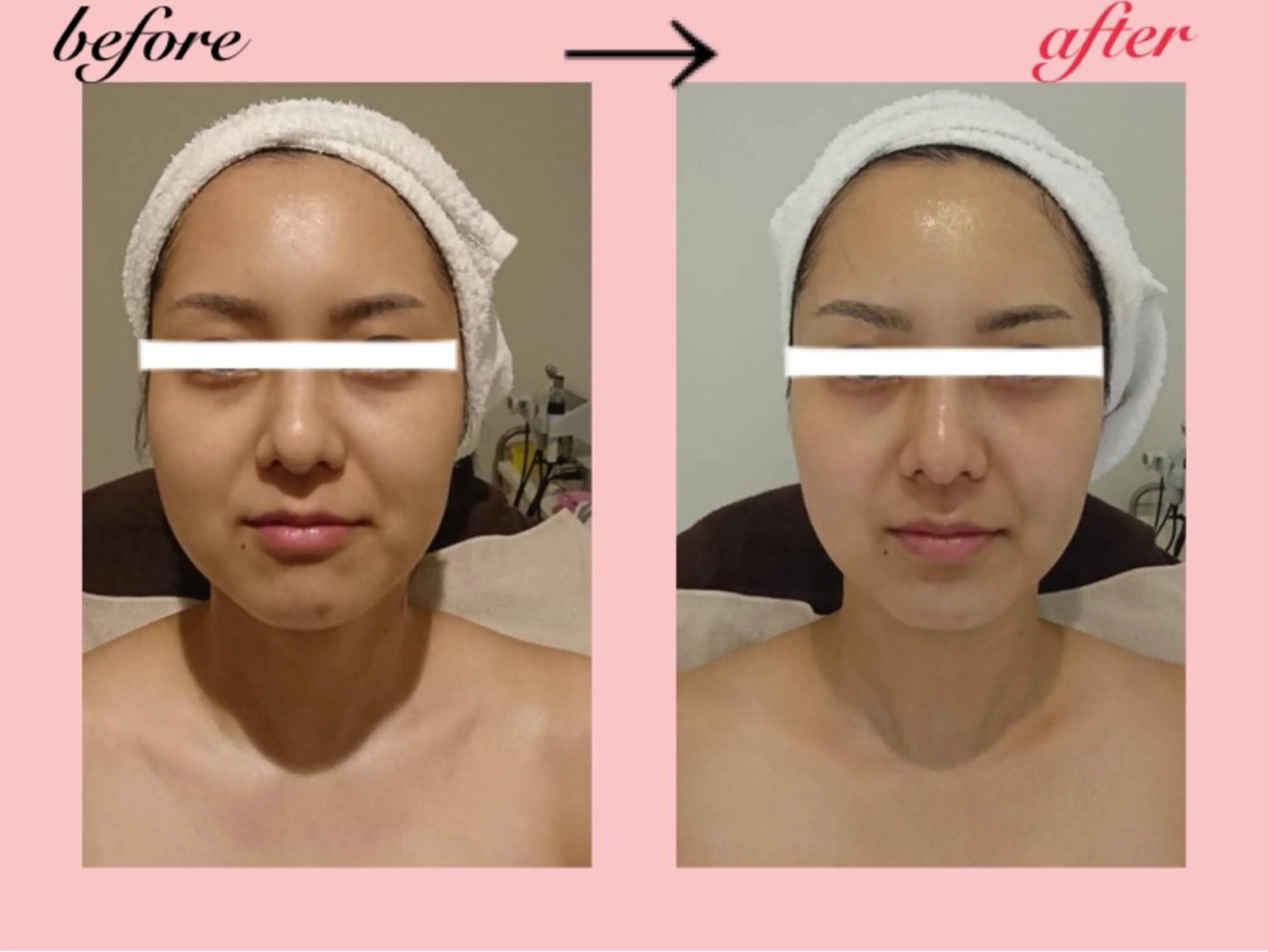 エステ リラク POLA SALON優美 山田店所属・POLA山田店 久原のその他イメージ