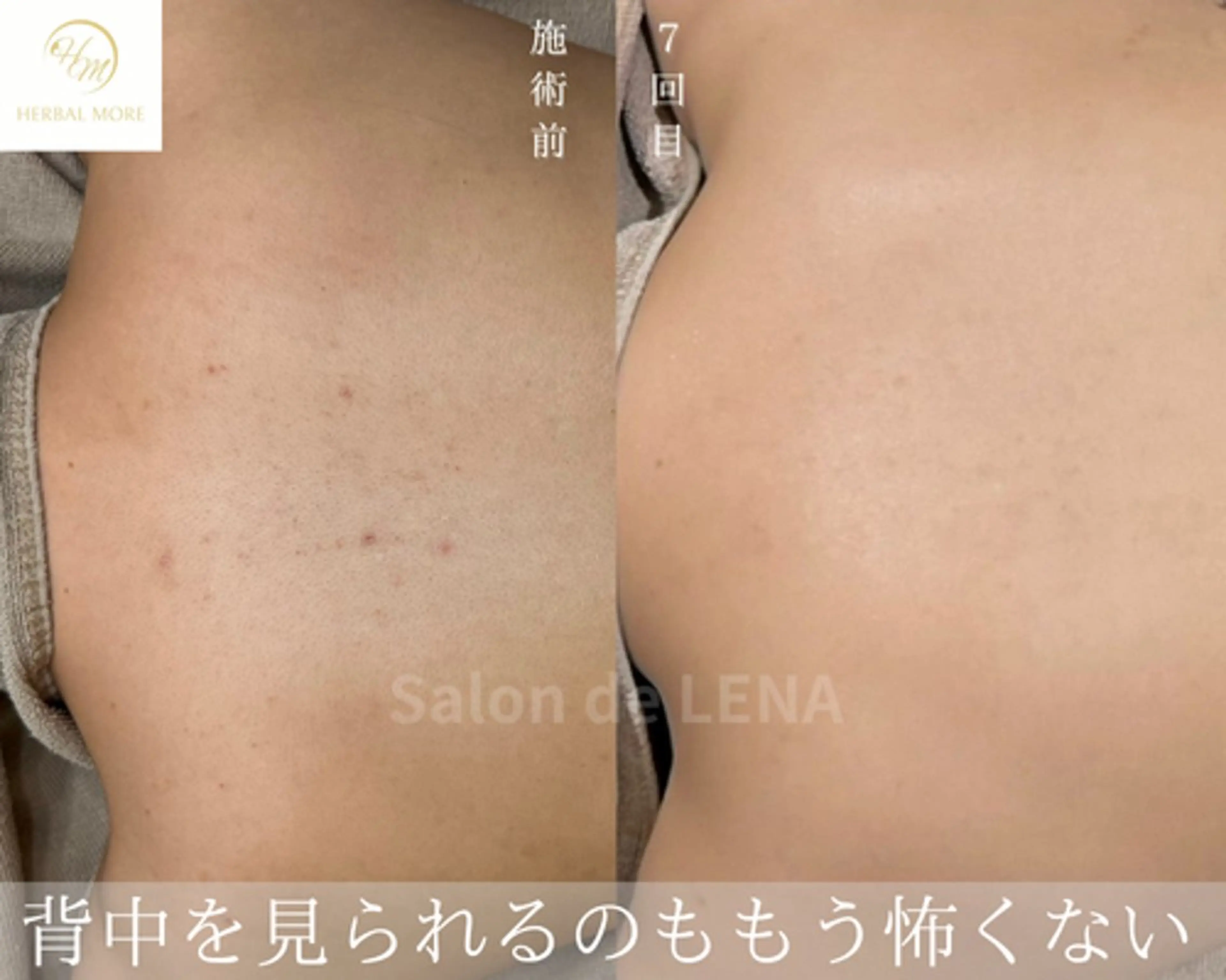 ハーブピーリング・毛穴ケア専門サロンSalon de LENA 栄店所属・ハーブピーリング専門 サロンドレナ　白藤のエステ・リラクイメージ