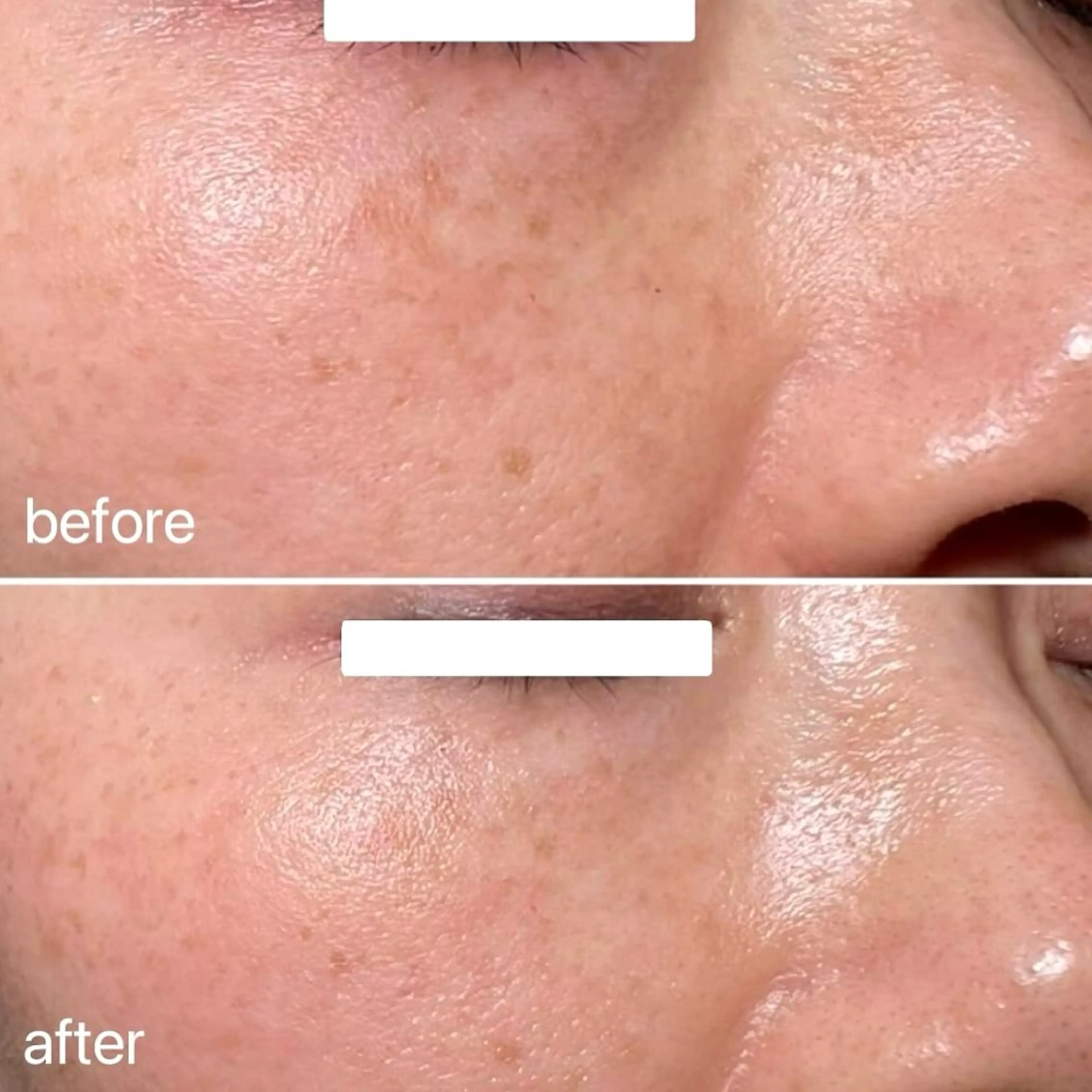 エステ ナスサロasuka. 🕯️🤎のエステ・リラクイメージ