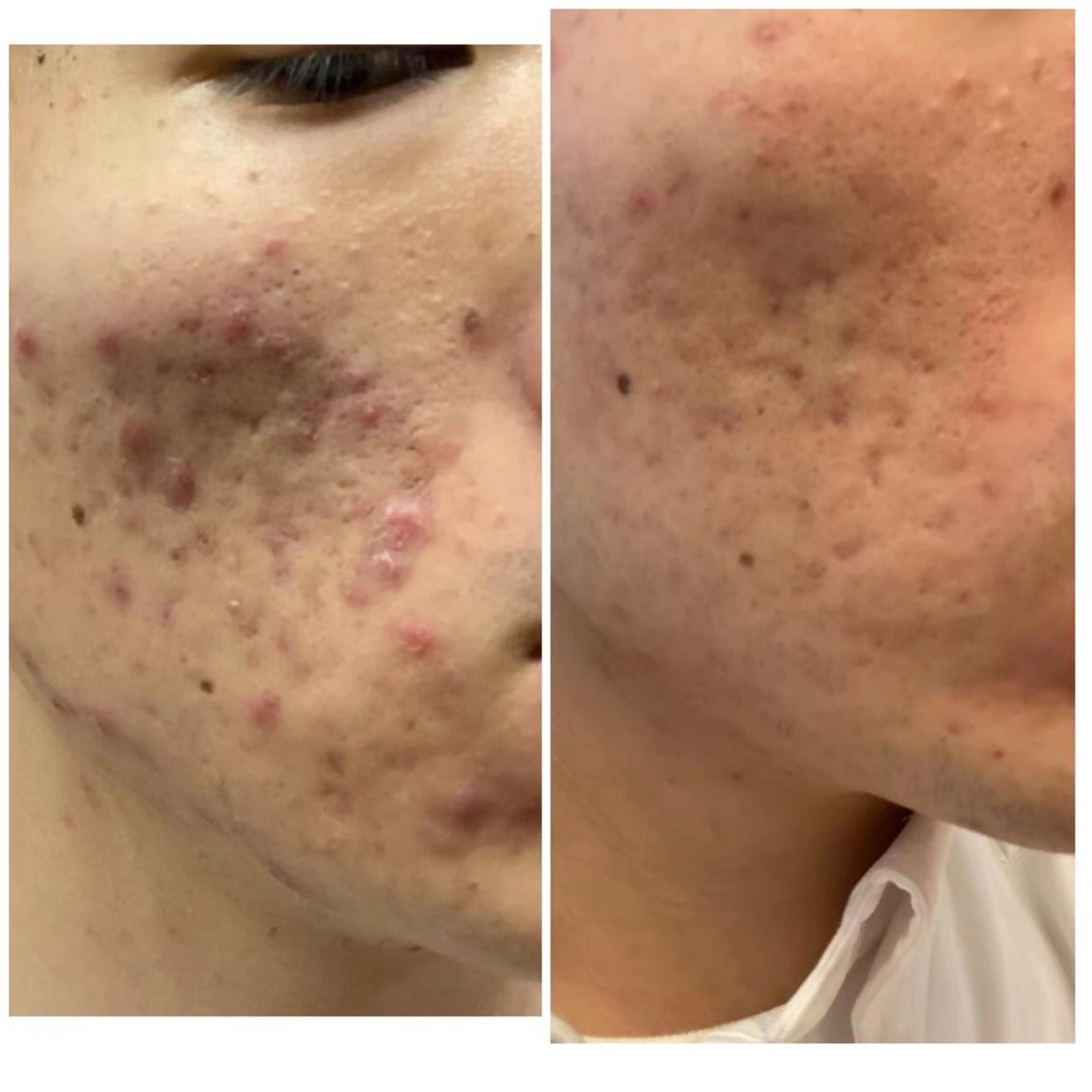 tominaga ryokoのヘアスタイル