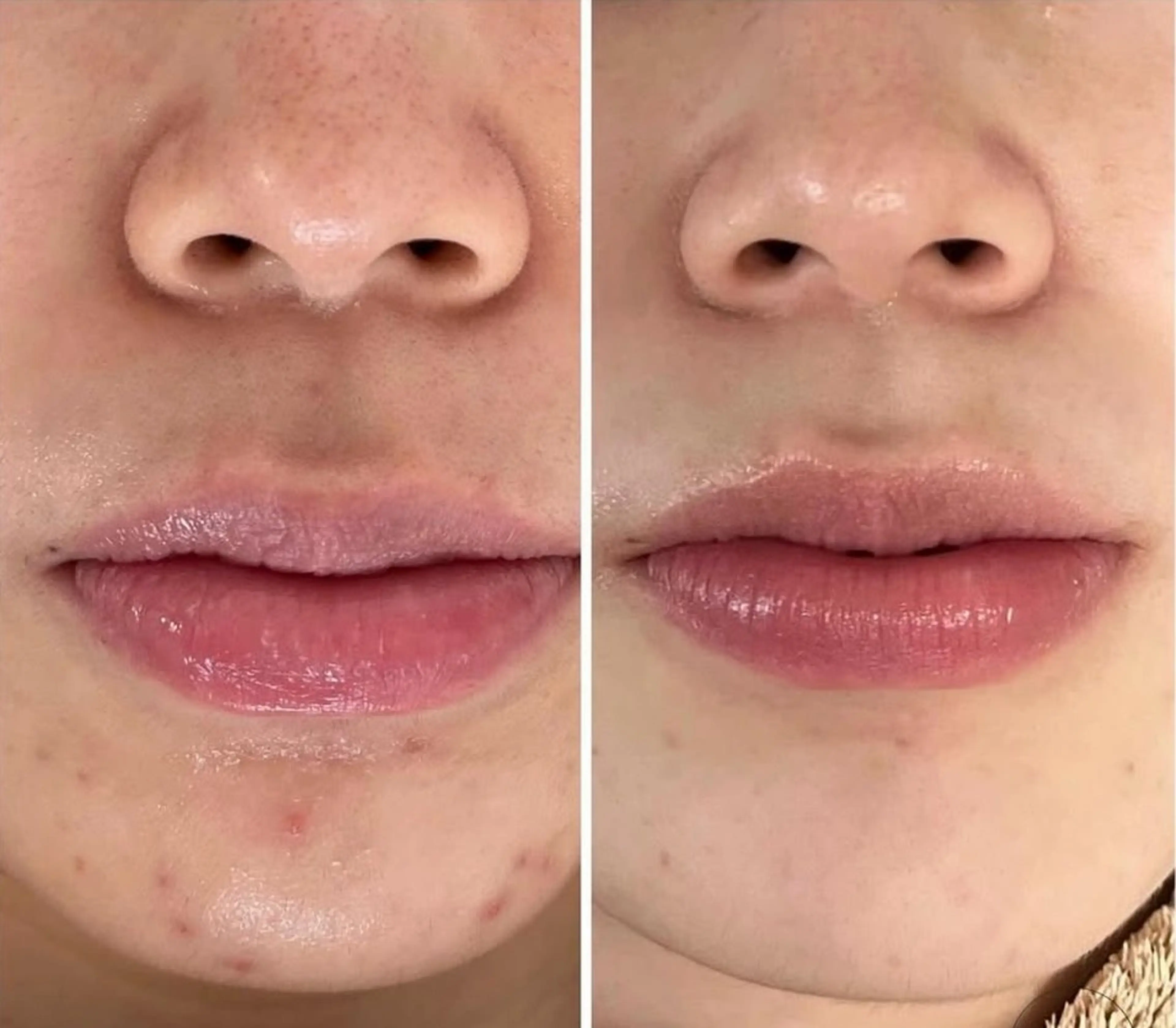 べアール所属・小顔/毛穴/ニキビ salon bealのエステ・リラクイメージ